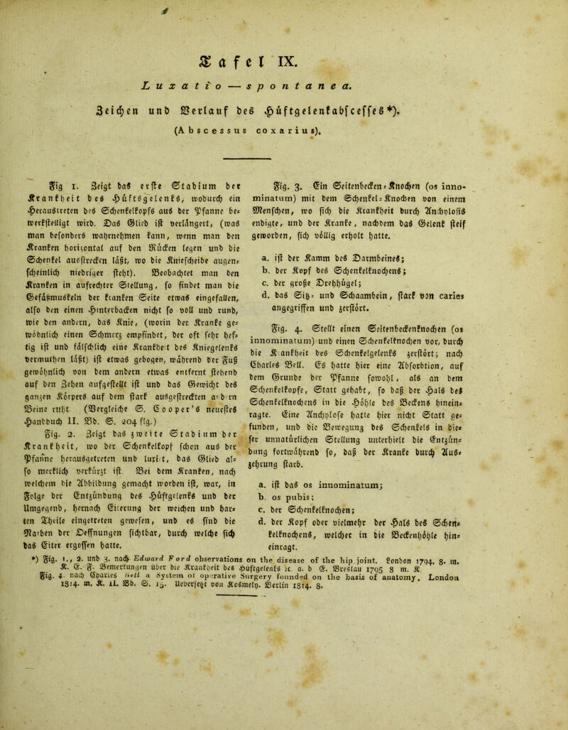 L u x a t i o — spontane a. 3€idjcn unb Verlauf beS «^üftgetcnfabfceffeS*). (Abscessus coxarius). gig i. 3etgt ba« erße ©t ab tum bet ÄcanEbeit beö $uftSgelenE«, woburd) ein $erau«treten be« ©cbenEetEopf« au« ber Pfanne be* Werfßelligt wirb. Da« ©lieb iß berlifngert, (waS man befonbers wabmebmen fann, wenn man ben ÄranEen horizontal auf ben StucEen fegen unb bie ©cbenEel aueßreefm ld§t, wo bie Äniefcbeibe äugen* fcbeinlicb niebriger flebt). Seobad)tet man ben üranEen in aufrechter ©tellung, fo ftnbet man bie ©efä&muSEeln bec EcanEen ©eite etwa« eingefallen, alfo ben einen ^mterbacEen niebt fo »oll unb runb, wie ben anbern, ba$ Änie, (worin ber ÄranEe ge* wotmlicb einen ©cbmerj empftnbet, ber oft febr bef* tig iß unb falfcblid) eine Äranfbed be« ÄniegelenE« termulben lagt) ifl etwa« gebogen, wäbrenb ber gufj gewöhnlich oon bem anbern etwas entfernt ffebenb auf ben geben aufgeßellt iß unb baS 05en?icfjt be« ganzen ÄorperS auf bem ßarE auSgeßcecEten a> b tn Seine ritt)t (Sergleicbe ©. ©ooper’ö neueße« $anbbud) II. Sb. ©. 204 flg.) gig. 2. geigt baS 5 weite ©tabtum ber ÄranEbeit, wo ber ©djenEelEopf fchon auS ber Pfanne berauSgetreten unb lupi t, baö ©lieb at* fo merflicl) nerEurjt iß. Sei bem ÄranEen, nadb Welcbem bie 2fbbilbung gemacht worben iß, war, in geige ber ©ntjunbung beS ^uftgelenEs unb ber Umgegenb, bemacb ©iterung ber weichen unb bar* ten Sbeile eingetreten gewefen, unb eS ßnb bie Farben ber Segnungen fiebtbar, burd) welche fidS> ba« ©iter ergoffen hatte. gig. 3. ©in ©ettenbetfert * Änod&en (0s inno- minatum) mit bem ©d)enEel= Änocben oon einem f8?enfd)en, wo ßcb bie ÄranEbeit burd) 2lnd)ploftS enbigte, unb ber ÄranEe, naebbem ba$ ©elenE ßeif geworben, ftd) oollig erholt batte. a. iß ber Äamm be« Darmbeine«; b. ber Äopf be« ©d)enEelEnod)en«; c. ber große Drehhutjel; d. ba« ©ih= unb ©ebaambein, ßarf bsn caries angegriffen unb jetßott. gig. 4. ©teilt einen ©eitenbeefenfnoeben (os innominatum) unb einen ©cbenfelfnocben t>or, burd) bie Ä anEbeit beS ©cbenEelgelenE« $erßort; nach ©barte« Seil, ©s batte l)icr eine 3fbforbtion, auf bem ©tunbe ber Pfanne fowobl, al« an bem ©djenEelEopfe, ©tatt gehabt, fo baß ber ^alö be« ©djenEelEnocbenS in bie .fjoble be« Secfen« hinein* ragte, ©ine 2fnd)ptofe batte bist nicht ©tatt ge* funben, unb bie Sercegung be« ©chenEel« in bie« fer unnatürlichen ©tellung unterhielt bie ©ntjun* bung fortwafwenb fo, baß ber Ätanfe burch 2fu«* jel)rung ßarb. a. iß ba« os innominatum; b. os pubis; c. ber ©cbenEelEnocben; d. ber .Kopf ober oielmebr ber $at« he« ©eben* felEnodjen«, weld)er tn bie Secfenbfyle fffn* eintagt. *) St0* *•/ 2- unb 3. nad> Edward Ford observations on the disease of the bip joint. 2onbon 1794. 8* llt. Ä. S. g. aSemertungen über bie tfran^eit be« .püftgetenf« 2c a. b @. SSreätau 1795 8 m. Ä gig. 4 nad) (Spane« Hell a dystern ot operative Surgery fonnded on the basis of anatomy, London iS>4. m, Ä. if. S3b. <3. ia. Ueoerfe^t oon ÄoSinelp. ffierltn 1814. 8.