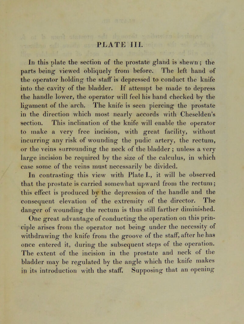 In this plate the section of the prostate gland is shewn ; the parts being viewed obliquely from before. The left hand of the operator holding the staff is depressed to conduct the knife into the cavity of the bladder. If attempt be made to depress the handle lower, the operator will feel his hand checked by the ligament of the arch. The knife is seen piercing the prostate in the direction which most nearly accords with Cheselden’s section. This inclination of the knife will enable the operator to make a very free incision, with great facility, without incurring any risk of wounding the pudic artery, the rectum, or the veins surrounding the neck of the bladder ; unless a very large incision be required by the size of the calculus, in which case some of the veins must necessarily be divided. In contrasting this view with Plate I., it will be observed that the prostate is carried somewhat upward from the rectum; this effect is produced by the depression of the handle and the consequent elevation of the extremity of the director. The danger of wounding the rectum is thus still farther diminished. One great advantage of conducting the operation on this prin- ciple arises from the operator not being under the necessity of withdrawing the knife from the groove of the staff, after he has once entered it, during the subsequent steps of the operation. The extent of the incision in the prostate and neck ot the bladder may he regulated by the angle which the knife makes ill its introduction with the staff*. Supposing that an opening