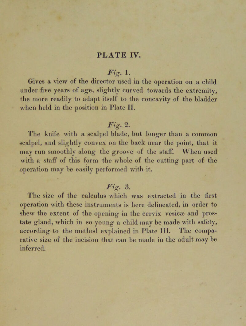 Fig. 1. Gives a view of the director used in the operation on a child under five years of age, slightly curved towards the extremity, the more readily to adapt itself to the concavity of the bladder when held in the position in Plate II. Fig. 2. The knife with a scalpel blade, but longer than a common scalpel, and slightly convex on the back near the point, that it may run smoothly along the groove of the staff*. When used with a staff* of this form the whole of the cutting part of the operation may be easily performed with it. Fig. 3. The size of the calculus which was extracted in the first operation with these instruments is here delineated, in order to shew the extent of the opening in the cervix vesicae and pros- tate gland, which in so young a child may be made with safety, according to the method explained in Plate III. The compa- rative size of the incision that can be made in the adult may be inferred.