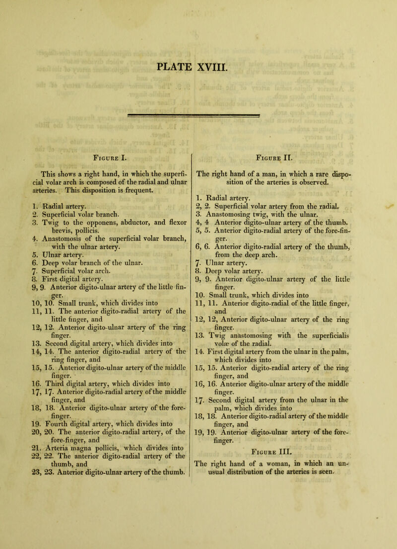 Figure I. This shows a right hand, in which the superfi- cial volar arch is composed of the radial and ulnar arteries. This disposition is frequent. 1. Radial artery. 2. Superficial volar branch. 3. Twig to the opponens, abductor, and flexor brevis, poUicis. 4. Anastomosis of the superficial volar branch, with the ulnar artery. 5. Ulnar artery. 6. Deep volar branch of the ulnar. 7. Superficial volar arch. 8. First digital artery. 9. 9- Anterior digito-ulnar artery of the little fin- ger. 10. 10. Small trunk, which divides into 11. 11. The anterior digito-radial artery of the little finger, and 12. 12. Anterior digito-ulnar artery of the ring finger. 13. Second digital artery, which divides into 14. 14. The anterior digito-radial artery of the ring finger, and 15. 15. Anterior digito-ulnar artery of the middle finger. 16. Third digital artery, which divides into 17. 17- Anterior digito-radial artery of the middle finger, and 18. 18. Anterior digito-ulnar artery of the fore- finger. 19- Fourth digital artery, which divides into 20, 20. The anterior digito-radial artery, of the fore-finger, and 21..'Arteria magna pollicis, which divides into 22, 22. The anterior digito-radial artery of the thumb, and 23, 23. Anterior digito-ulnar artery of the thumb. Figure IT. The right hand of a man, in which a rare dispo* sition of the arteries is observed. 1, Radial artery, 2, 2. Superficial volar artery from the radial. 3, Anastomosing twig, with the ulnar. 4, 4 Anterior digito-ulnar artery of the thumb. 5, 5. Anterior digito-radial artery of the fore-fin- ger. 6, 6. Anterior digito-radial artery of the thumb, from the deep arch. 7, Ulnar artery. 8, Deep volar artery. 9, 9- Anterior digito-ulnar artery of the little finger. 10, Small trunk, which divides into 11, 11. Anterior digito-radial of the little finger, and 12, 12, Anterior digito-ulnar artery of the ring finger. 13, Twig anastomosing with the superficialis volm of the radial. 14, First digital artery from the ulnar in the palm, which divides into 15, 15, Anterior digito-radial artery of the ring finger, and 16, 16. Anterior digito-ulnar artery of the middle finger. 17- Second digital artery from the ulnar in the palm, which divides into 18, 18. Anterior digito-radial artery of the middle finger, and 19, 19- Anterior digito-ulnar artery of the fore- finger. Figure III. The right hand of a woman, in which an un- usual distribution of the arteries is seen.
