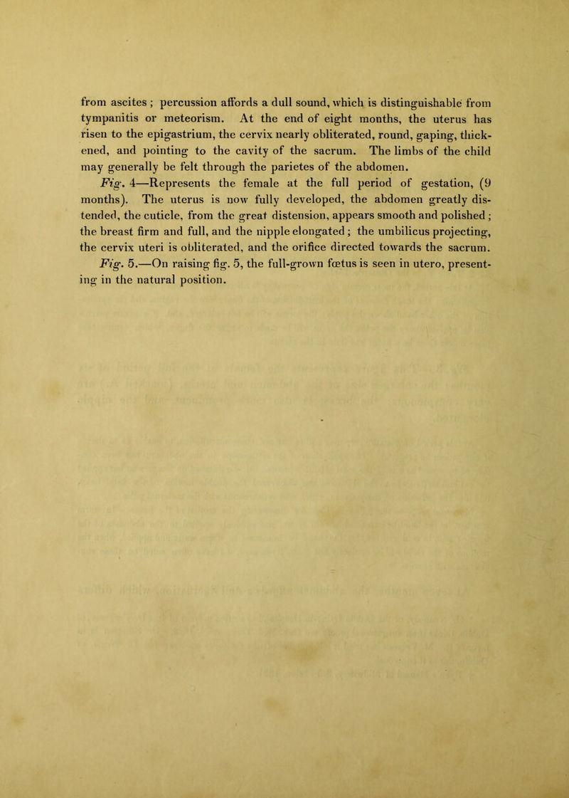 from ascites ; percussion affords a dull sound, which is distinguishable from tympanitis or meteorism. At the end of eight months, the uterus has risen to the epigastrium, the cervix nearly obliterated, round, gaping, thick- ened, and pointing to the cavity of the sacrum. The limbs of the child may generally be felt through the parietes of the abdomen. Fig. 4—Represents the female at the full period of gestation, (9 months). The uterus is now fully developed, the abdomen greatly dis- tended, the cuticle, from the great distension, appears smooth and polished ; the breast firm and full, and the nipple elongated ; the umbilicus projecting, the cervix uteri is obliterated, and the orifice directed towards the sacrum. Fig. 5.—On raising fig. 5, the full-grown foetus is seen in utero, present- ing in the natural position.