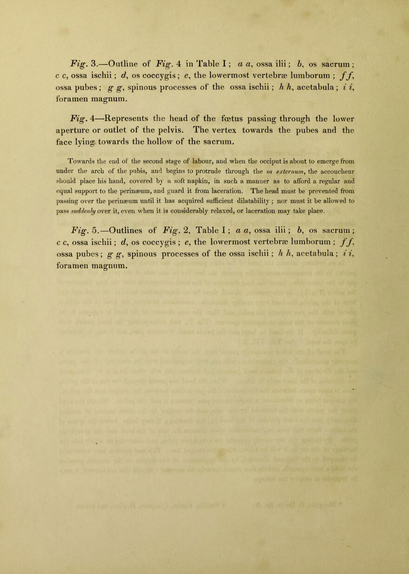 c c, ossa ischii; d, os coccygis; e, the lowermost vertebrae lumborum ; ff, ossa pubes; g g, spinous processes of the ossa ischii; h h, acetabula; i i, foramen magnum. Fig. 4—Represents the head of the foetus passing through the lower aperture or outlet of the pelvis. The vertex towards the pubes and the face lying towards the hollow of the sacrum. Towards the end of the second stage of labour, and when the occiput is about to emerge from under the arch of the pubis, and begins to protrude through the os externum, the accoucheur should place his hand, covered by a soft napkin, in such a manner as to afford a regular and equal support to the perineeum, and guard it from laceration. The head must be prevented from passing over the perineeum until it has acquired sufficient dilatability ; nor must it be allowed to pass suddenly over it, even when it is considerably relaxed, or laceration may take place. Fig. 5.—Outlines of Fig. 2, Table I; a a, ossa ilii; 6, os sacrum ; c c, ossa ischii; d, os coccygis ; e, the lowermost vertebrae lumborum ; ff ossa pubes ; g g, spinous processes of the ossa ischii; h h, acetabula ; i i, foramen magnum.
