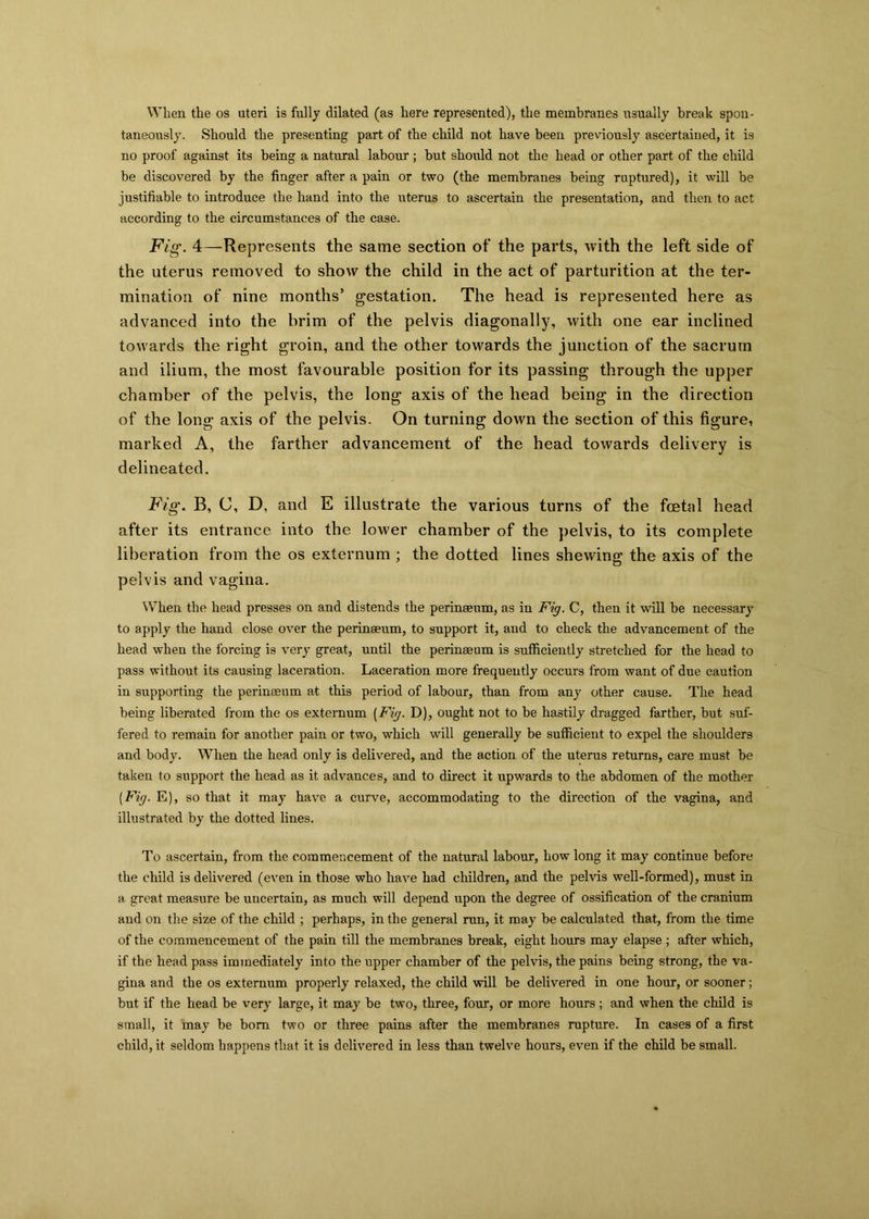 When the os uteri is fully dilated (as here represented), the membranes usually break spon- taneously. Should the presenting part of the child not have been previously ascertained, it is no proof against its being a natural labour ; but should not the head or other part of the child be discovered by the finger after a pain or two (the membranes being ruptured), it will be justifiable to introduce the hand into the uterus to ascertain the presentation, and then to act according to the circumstances of the case. Fig. 4—Represents the same section of the parts, with the left side of the uterus removed to show the child in the act of parturition at the ter- mination of nine months’ gestation. The head is represented here as advanced into the brim of the pelvis diagonally, with one ear inclined towards the right groin, and the other towards the junction of the sacrum and ilium, the most favourable position for its passing through the upper chamber of the pelvis, the long axis of the head being in the direction of the long axis of the pelvis. On turning down the section of this figure, marked A, the farther advancement of the head towards delivery is delineated. Fig. B, C, D, and E illustrate the various turns of the foetal head after its entrance into the lower chamber of the pelvis, to its complete liberation from the os externum ; the dotted lines shewing the axis of the pelvis and vagina. When the head presses on and distends the perinseum, as in Fig. C, then it will be necessary to apply the hand close over the perinseum, to support it, and to check the advancement of the head when the forcing is very great, until the perinseum is sufficiently stretched for the head to pass without its causing laceration. Laceration more frequently occurs from want of due caution in supporting the perinseum at this period of labour, than from any other cause. The head being liberated from the os externum [Fig. D), ought not to be hastily dragged farther, but suf- fered to remain for another pain or two, which will generally be sufficient to expel the shoulders and body. When the head only is delivered, and the action of the uterus returns, care must be taken to support the head as it advances, and to direct it upwards to the abdomen of the mother [Fig. E), so that it may have a curve, accommodating to the direction of the vagina, and illustrated by the dotted lines. To ascertain, from the commencement of the natural labour, how long it may continue before the child is delivered (even in those who have had children, and the pelvis well-formed), must in a great measure be uncertain, as much will depend upon the degree of ossification of the cranium and on the size of the child ; perhaps, in the general run, it may be calculated that, from the time of the commencement of the pain till the membranes break, eight hours may elapse ; after which, if the head pass immediately into the upper chamber of the pelvis, the pains being strong, the va- gina and the os externum properly relaxed, the child will be delivered in one hour, or sooner; but if the head be very large, it may be two, three, four, or more hours ; and when the child is small, it may be bom two or three pains after the membranes rapture. In cases of a first child, it seldom happens that it is delivered in less than twelve hours, even if the child be small.