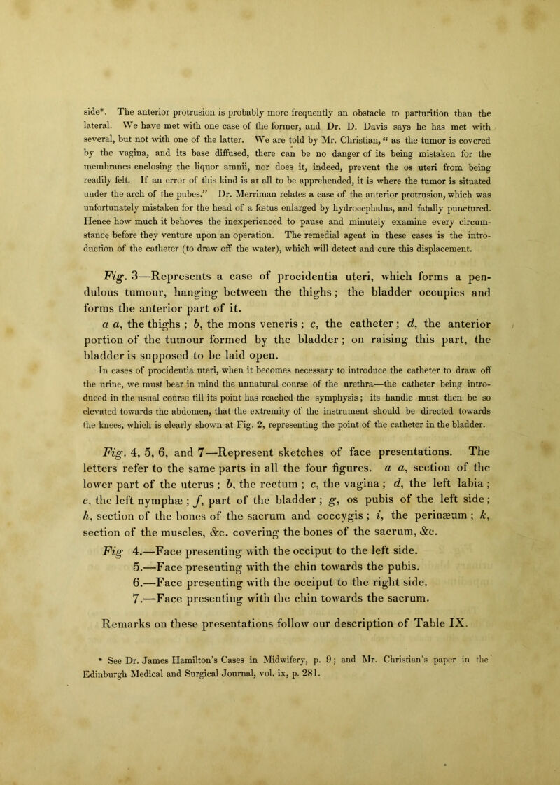 side*. The anterior protrusion is probably more frequently an obstacle to parturition than the lateral. We have met with one case of the former, and Dr. D. Davis says he has met with several, but not with one of the latter. We are told by Mr. Christian, “ as the tumor is covered by the vagina, and its base diffused, there can be no danger of its being mistaken for the membranes enclosing the liquor amnii, nor does it, indeed, prevent the os uteri from being readily felt. If an error of this kind is at all to be apprehended, it is where the tumor is situated under the arch of the pubes.” Dr. Merriman relates a case of the anterior protrusion, which was unfortunately mistaken for the head of a foetus enlarged by hydrocephalus, and fatally punctured. Hence how much it behoves the inexperienced to pause and minutely examine every circum- stance before they venture upon an operation. The remedial agent in these cases is the intro- duction of the catheter (to draw off the water), which will detect and cure this displacement. Fig. 3—Represents a case of procidentia uteri, which forms a pen- dulous tumour, hanging between the thighs; the bladder occupies and forms the anterior part of it. a a, the thighs ; 6, the mons veneris; c, the catheter; d, the anterior portion of the tumour formed by the bladder ; on raising this part, the bladder is supposed to be laid open. In cases of procidentia uteri, when it becomes necessary to introduce the catheter to draw off the urine, we must bear in mind the unnatural course of the urethra—the catheter being intro- duced in the usual course till its point has reached the symphysis ; its handle must then be so elevated towards the abdomen, that the extremity of the instrument should be directed towards the knees, which is clearly shown at Fig. 2, representing the point of the catheter in the bladder. Fig. 4, 5, 6, and 7—Represent sketches of face presentations. The letters refer to the same parts in all the four figures, a a, section of the lower part of the uterus ; b, the rectum ; c, the vagina ; d, the left labia ; e, the left nymphse ; f, part of the bladder ; g, os pubis of the left side ; h, section of the bones of the sacrum and coccygis ; i, the perinaeum ; k, section of the muscles, &c. covering the bones of the sacrum, &e. Fig 4.—Face presenting with the occiput to the left side. 5. —Face presenting with the chin towards the pubis. 6. —Face presenting with the occiput to the right side. 7. —Face presenting with the chin towards the sacrum. Remarks on these presentations follow our description of Table IX. * See Dr. James Hamilton’s Cases in Midwifery, p. 9; and Mr. Christian’s paper in the' Edinburgh Medical and Surgical Journal, vol. ix, p. 281.