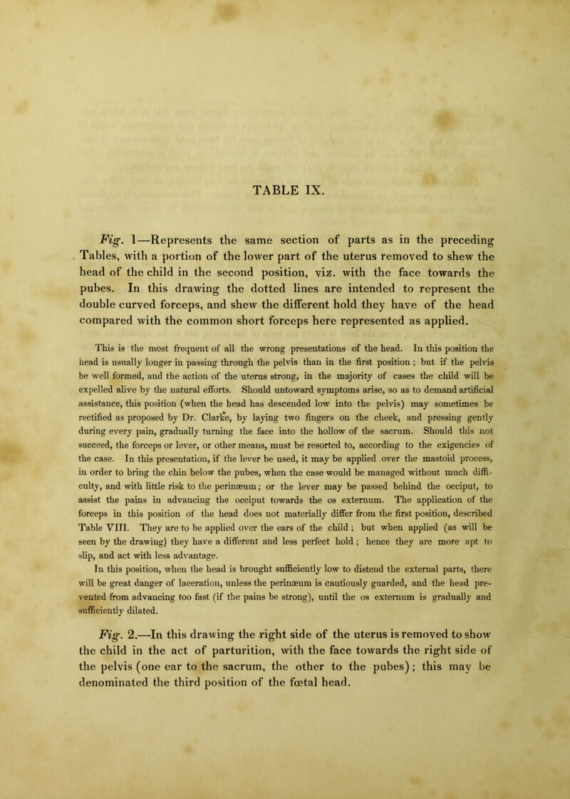 TABLE IX. Fig. 1—Represents the same section of parts as in the preceding Tables, with a portion of the lower part of the uterus removed to shew the head of the child in the second position, viz. with the face towards the pubes. In this drawing the dotted lines are intended to represent the double curved forceps, and shew the different hold they have of the head compared with the common short forceps here represented as applied. This is the most frequent of all the wrong presentations of the head. In this position the head is usually longer in passing through the pelvis than in the first position ; but if the pelvis be well formed, and the action of the uterus strong, in the majority of eases the child will be expelled alive by the natural efforts. Should untoward symptoms arise, so as to demand artificial assistance, this position (when the head has descended low into the pelvis) may sometimes be rectified as proposed by Dr. Clark'e, by laying two fingers on the cheek, and pressing gently during every pain, gradually turning the face into the hollow of the sacrum. Should this not succeed, the forceps or lever, or other means, must be resorted to, according to the exigencies of the case. In this presentation, if the lever be used, it may be applied over the mastoid process, in order to bring the chin below the pubes, when the case would be managed without much diffi- culty, and with little risk to the perinoeum; or the lever may be passed behind the occiput, to assist the pains in advancing the occiput towards the os externum. The application of the forceps in this position of the head does not materially differ from the first position, described Table VIII. They are to be applied over the ears of the child ; but when applied (as will be seen by the drawing) they have a different and less perfect hold ; hence they are more apt to slip, and act with less advantage. In this position, when the head is brought sufficiently low to distend the external parts, there will be great danger of laceration, unless the perinoeum is cautiously guarded, and the head pre- vented from advancing too fast (if the pains be strong), until the os externum is gradually and sufficiently dilated. Fig. 2.—In this drawing the right side of the uterus is removed to show the child in the act of parturition, with the face towards the right side of the pelvis (one ear to the sacrum, the other to the pubes); this may be denominated the third position of the foetal head.