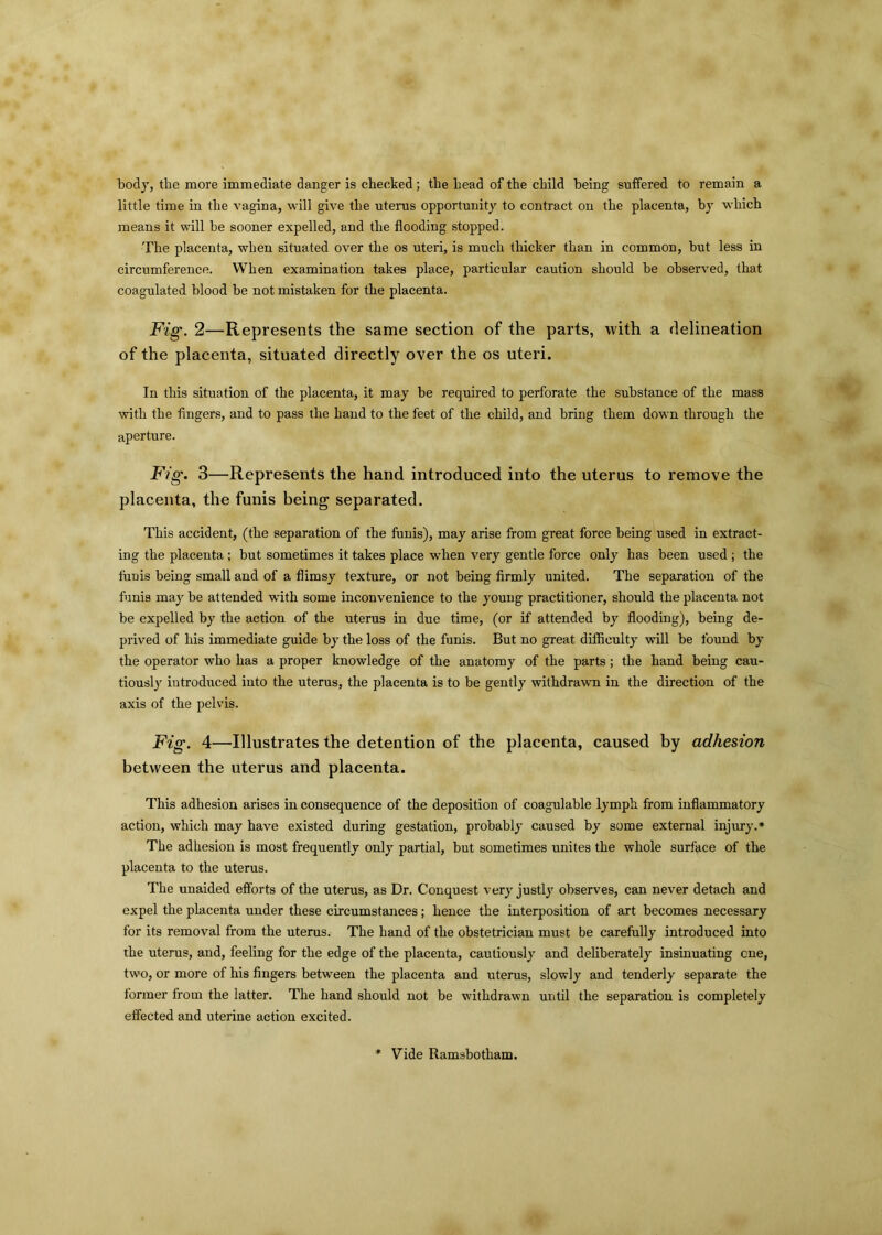 body, the more immediate danger is checked; the head of the child being suffered to remain a little time in the vagina, will give the uterus opportunity to contract on the placenta, by which means it will be sooner expelled, and the flooding stopped. The placenta, when situated over the os uteri, is much thicker than in common, but less in circumference. When examination takes place, particular caution should be observed, that coagulated blood be not mistaken for the placenta. Fig. 2—Represents the same section of the parts, with a delineation of the placenta, situated directly over the os uteri. In this situation of the placenta, it may be required to perforate the substance of the mass with the fingers, and to pass the hand to the feet of the child, and bring them down through the aperture. Fig. 3—Represents the hand introduced into the uterus to remove the placenta, the funis being separated. This accident, (the separation of the funis), may arise from great force being used in extract- ing the placenta ; but sometimes it takes place when very gentle force only has been used ; the funis being small and of a flimsy texture, or not being firmly united. The separation of the funis may be attended writh some inconvenience to the young practitioner, should the placenta not be expelled by the action of the uterus in due time, (or if attended by flooding), being de- prived of his immediate guide by the loss of the funis. But no great difficulty will be found by the operator who has a proper knowledge of the anatomy of the parts ; the hand being cau- tiously introduced into the uterus, the placenta is to be gently withdrawn in the direction of the axis of the pelvis. Fig. 4 —Illustrates the detention of the placenta, caused by adhesion between the uterus and placenta. This adhesion arises in consequence of the deposition of coagulable lymph from inflammatory action, which may have existed during gestation, probably caused by some external injury.* The adhesion is most frequently only partial, but sometimes unites the whole surface of the placenta to the uterus. The unaided efforts of the uterus, as Dr. Conquest very justly observes, can never detach and expel the placenta under these circumstances; hence the interposition of art becomes necessary for its removal from the uterus. The hand of the obstetrician must be carefully introduced into the uterus, and, feeling for the edge of the placenta, cautiously and deliberately insinuating one, two, or more of his fingers between the placenta and uterus, slowly and tenderly separate the former from the latter. The hand should not be withdrawn until the separation is completely effected and uterine action excited. Vide Ramsbotham.