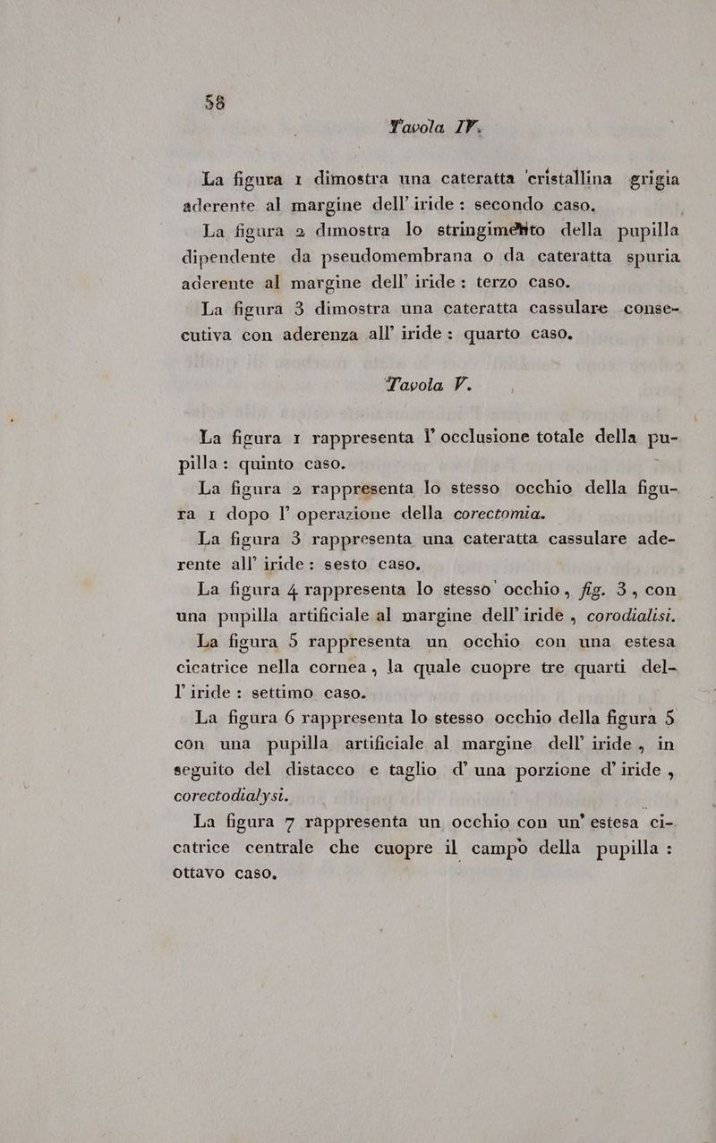 Yavola IV. La figura 1 dimostra una cateratta ‘cristallina grigia aderente al margine delliride : secondo caso. La figura 2 dimostra lo stringimetito della pupilla dipendente da pseudomembrana o da cateratta spuria aderente al margine dell’ iride : terzo caso. | La figura 3 dimostra una cateratta cassulare .conse- cutiva con aderenza all’ iride : quarto caso. Tavola V. La figura 1 rappresenta Î’ occlusione totale della pu- pilla : quinto caso. La figura 2 rappresenta lo stesso occhio della figu- ra 1 dopo l’ operazione della corectomia. La figura 3 rappresenta una cateratta cassulare ade- rente all’ iride : sesto caso. La figura 4 rappresenta lo stesso occhio, fig. 3, con una pupilla artificiale al margine dell’ iride , corodialisi. La figura 5 rappresenta un occhio con una estesa cicatrice nella cornea, la quale cuopre tre quarti del- l’ iride : settimo caso. La figura 6 rappresenta lo stesso occhio della figura 5 con una pupilla artificiale al margine dell’ iride, in seguito del distacco e taglio d’ una porzione d'’ iride , corectodtialysi. La figura 7 rappresenta un occhio con un’ estesa ci- catrice centrale che cuopre il campo della pupilla : ottavo caso,