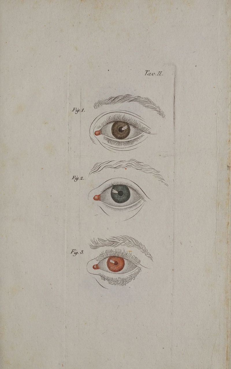 VEZIIOIA DD i la E 1 Note