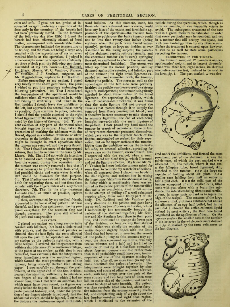 calm and soft. I gave her ten grains of in- spissated ox-gall, ordering a repetition of the dose early in the morning, if the bowels had not been previously moved. In the forenoon of the following day (the 12th) I found the bowels had been effectually cleared of foecal matter, accompanied with considerable flatus. The thermometer indicated the temperature to be 68 deg. and the room not being a large one, coupled with the expectation of six or seven medical friends at the operation, I judged it unnecessary to raise the temperature artificially. At three o’clock p.m. the following gentlemen assembled at my own house:—Dr. Radford, Dr. Black. Messrs. W. C. Vaudrey, Nursaw( G7 Southam, J. J. Southam, surgeons, and Mr. Higginbottom, nephew to Dr. Radford. Before proceeding to my patient, I stated very briefly to the above gentlemen, the plans I wished to put into practice; embracing the following particulars. 1st. That I considered the temperature of the apartment would be sufficient when all were assembled in it, with- out raising it artificially. 2nd. That in the first incision I should leave the umbilicus to the left, but approach the central line as nearly as possible, from sternum to pubes, believing I should find the pedicle attached to the right broad ligament of the uterus, as slightly indi- cated by the history of the case. 3rd. To pre- vent eversion of any part of the wound when brought together by suture, I had taken the precaution of marking the abdomen with fine thread, dipped in a solution of nitrate of silver, crosswise to the incision, that the same parts might be brought in exact apposition when the tumour was removed, and the parts flaccid. 4th. That 1 should use more of the interrupted sutures, than had been done in the cases by Mr. Lizars. 5th. That I did not wish the intestines to be handled even though they might escape from the wound, during the operation, until the tumour was entirely removed ; but that if it was necessary to protect them from cold, I had provided cloths and warm water in which lard would be dissolved for that purpose. 6th. That if adhesions existed I should use the knife for separating them, and not force them asunder with the fingers unless of a very recent character. 7th. That in the after treatment I should avoid, as much as possible, opiates and stimulants. I then, accompanied by my medical friends, proceeded to the house of my patient: she was cheerful, and free from excitement, having pre- pared everything for the occasion that, was thought necessary. The pulse still stood at 70; soft and compressible OPERATION. I placed my patient on a long narrow table covered with blankets, her head a little raised with pillows, and the abdominal parietes so situated that the best light the room afforded fell upon the part to be operated on ; taking my station on the patient’s right side, with a large scalpel, I severed the integuments from within a short distance of the ensiform cartilage, to the pubes at one stroke : at this time it was remarked, how extremely thin the integuments were immediately over the umbilical region, which formed the most prominent part of the tumour, being scarcely thicker than strong paper. I now carefully cut through the peri- toneum, at the upper end of the first incision, nearest the sternum, sufficiently to introduce two fingers of my left hand, which I had no sooner done, than I met with an adhesion, but which must have been recent, as it gave way easily before the fingers. I now introduced the probe pointed bistoury, and, under the protec- tion of my fingers already introduced, lest the abdominal viscera should be injured, I cut with the bistoury the peritoneum equal to the out- ward incision. At this moment, none, but those who have witnessed such a scene, could have any idea of the extent and formidable ap- pearance of the operation—the incision from sternum to pubis over the bulky tumour could not be less than twenty-four inches (being eighteen when the parts were flaccid subse- quently), perhaps as large an incision as ever was made in the living subject; the parietes of the abdomen rapidly retiring laterally, and the enormous tumour (as it were) springing forward, was sufficient to startle the coolest and most determined individual. The uterus was lifted up fom its normal position, and lay flattened against the anterior, and inferior, part of the tumour; its right broad ligament ex- panded on, and connected with, the tumour, forming its pedicle. The uterus as well as the appendages on the left side were perfectly healthy; the pedicle was then secured by a strong ligature, and separated ; the tumour being firmly attached to about three inches of the broad ligament. On separating the pedicle, which was of considerable thickness, it was found that the main ligature did not prevent the vessels (that passed through it to supply the tumour) from freely pouring out blood; and it therefore became necessary to take them up in separate ligatures, one end of each being brought outwards with the main ligature of the pedicle. I now passed my hand round the tumour in search of adhesions; three or four of very recent character presented themselves, which gave way to the slightest touch of the fingers, and required no scalpel for their sepa- ration, but on the upper surface of the tumour, higher than the umbilicus and on the patient’s left side, an omental adhesion, spreading for some space on the tumour, shewed itself; this I separated with the scalpel, when a small vessel poured out blood freely, which I secured and cut the ligature off close. My friend Mr. W. C. Vaudrey had now held the tumour raised for some time, to facilitate my search for adhesions ; when all appeared clear I placed my hands in the iliac regions, and assisted him in raising the huge mass fairly from the abdominal cavity, in doing which a considerable force was re- quired as the pelvic portion of the tumour filled that cavity so completely, that it felt similar to the attempt of pulling off a well exhausted cupping glass, from some fleshy part of the body. Dr. Radford and Mr Vaudrey paid every attention to the patient and gave her a tea-spronful ortwo of brandy and water, whilst I immediately but temporarily brought the parietes of the abdomen together; Mr. Nur- saw and Mr Southam kept them in their posi- tion, and I continued to sponge the lower part of the incision, as long as any fluid shewed itself, which was chiefly the remains of the ascitic deposit slightly tinged with the little blood that had been lost in securing the vessels of the pedicle; long as this account may ap- pear, the time consumed up to this, was only twelve minutes and a half, and (as I had no ambition of making it a bloodless operation) about fourteen ounces were lost rather more than in all probability would have been, incon- sequence of one of the ligatures missing its hold, but, after all, no more than (in my opi- nion) benefitted the patient afterwards. The integuments were brought together by nine stitches, and straps of adhesive plaister between each, with long straps over the ends of the cross straps ; and two long pads of linen were laid on either side of the incision, and over all a stout bandage of some breadth. My patient was then carefully lifted into bed, about forty- five minutes from the commencement; cheer- ful, and complaining only of a pain about the last lumbar vertebrae and right iliac region, which I attributed to the extension of the pedicle during the operation, which, though as little as possible, it was impossible wholly to avoid. The subsequent treatment of the case will in a great measure be tabulated in order that every particular may be recorded, and yet in a manner that will occupy less space, and with less tautology than by any other means. Before the treatment is entered upon however, it will be as well to state some particulars respecting the tumour. DESCRIPTION OF THE Tl'MOOB. The tumour weighed 17 pounds 5 ounces, apothecaries’ weight, and its largest circumfe- rence was three feet, eight inches, its shortest circumference two feet, inclined to be oval in its forra,^. 1. The part marked a was situ- ated under the umbilicus, and formed the most prominent part of the abdomen, b was the pelvic mass, of which the part marked c was ulcerated, d, the pedicle, where it was cut. e the fallopian tube, broad ligament, &c., attached to the tumour, f f f the large sac capable of holding about six pints, g g q smaller sacs holding from half an ounce to half a pint each, h h h the solid part of the tumour composed of still smaller cells, filled some with pus, others with a brain-like sub- stance, the interstices being fibrous and cartila- ginous, in some parts so hard as to injure the edge of the scalpel. The contents of the large sac were a thick glutinous substance not unlike the albumen of an egg half boiled, but in no part did I observe the coffee-coloured liquid noticed by most writers ; the fluid here found coagulated on the application of heat. On the opposite surface the smaller sacs,to the number of six or seven in the whole,were more distinct as in fig. 2, marked by the same references as the last diagram.