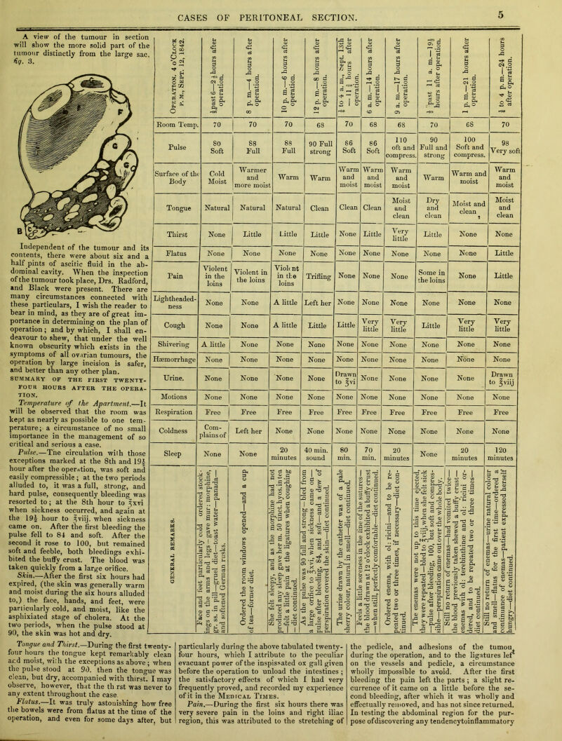 A view of the tumour in section will show the more solid part of the tumour distinctly from the large sac, fi.q. 3. Independent of the tumour and its contents, there were about six and a half pints of ascitic fluid in the ab- dominal cavity. When the inspection of the tumour took place, Drs. Radford, and Black were present. There are many circumstances connected with these, particulars, I wish the reader to bear in mind, as they are of great im- portance in determining on the plan of operation ; and by which, I shall en- deavour to shew, that under the well known obscurity which exists in the symptoms of all ovarian tumours, the operation by large incision is safer, and better than any other plan. SUMMARY OF THE FIRST TWENTY- FOUR HOURS AFTER THE OPERA- TION. Temperature of the Apartment.—It will be observed that the room was kept as nearly as possible to one tem- perature; a circumstance of no small importance in the management of so critical and serious a case. Pulse.—The circulation wilh those exceptions marked at the 8th and 19f hour after the operation, was soft and easily compressible ; at the two periods alluded to, it was a full, strong, and hard pulse, consequently bleeding was resorted to; at the 8th hour to ^xvi when sickness occurred, and again at the 19J hour to ^viij. when sickness came on. After the first bleeding the pulse fell to 84 and soft. After the second it rose to 100, but remained soft and feeble, both bleedings exhi- bited the buffy crust. The blood was taken quickly from a large orifice. Skin.—After the first six hours had expired, (the skin was generally warm and moist during the six hours alluded to,) the face, hands, and feet, were particularly cold, and moist, like the asphixiated stage of cholera. At the two periods, when the pulse stood at 90, the skin was hot and dry. M <N O rfi 9 GO M r-t o . o 2J •<* . *•& © w g” (X S a p; Room Temp. Pulse Surface of the Body Tongue Thirst Flatus 3 O -a -*■ s' es o +3 <D g o Oh H|W S3 o cB 70 70 80 Soft 88 Full Cold Moist Warmer and more moist Natural Natural None Pain Lightheaded- ness Cough None Little None Violent in the loins None None Violent in the loins None None Shivering Haemorrhage Urine. Motions Respiration Coldness Sleep A little None None None Free None 70 88 Full Warm 3 O -a 68 90 Full strong Warm Natural Little None Violi nt in the loins Clean Little None Trifling A little A little None Left her Little None None None Free Com- plains of Left her None None w ,3 TS Cfi Ch C d s ?< 3 <D £ 71 ■2 £ * s >> l 3 W5 I d be ^ ' p 2 Ec S ' CJ tv <3 J, 333 a-3 . c g ” D.-P? be ci None None None Free None 20 minutes TT Co Oil C Si --G fax) dm3 ,G O O ^ O 2-^3 © la 2-5 FH-S ^ §a ^ P-i a . '3 ^ ,<D -73 —• O 23° cols <2^3 s. I I None None None None 70 86 Soft Warm and moist Clean None -3* 3 S 3 68 86 Soft Warm and moist Clean Little None None 6 S s 3 68 110 oft and compress. Warm and moist Moist and clean Very little None None Little None None Drawn to ^vi None Free None 40 min. sound o | 'S g-S-g -3 § « g I 3 | § £ C |  ■d 'S3 S 'y § G ^ jL a» c .5 Si d ^ £ ~ M £*£ 00 £ > O *r=j & tn <D a> cS 2 j H ^ £ r Free None 80 min. a> 03 g o .y § o & “ o c3 a)  3 0) co ■So ►**“», -S3 c5 Ss 'a ® >> H I a None None None 70 90 Full and strong Warm . 3< 3. ° 6S 100 Soft and compress. Warm and moist Dry and clean Moist and clean Little None None Very little None None None None Free None Very little None None None None Free None 70 min. - 3 ■> G im 3.-2 l -S3 2 3 S s 21- • j S jj ce . 3-S2 ^Ti m * § 3 None Some in the loins None rr S S ® . p. cl, o 70 98 Very soft Warm and moist Moist and clean None None None None Little None None None None Very little None Little Little None Very little None None None None Free Free 20 minutes O n© Z J ■s a &- -73 O O 3 3 O) O None None None None Drawn to gviij None Free None None o> .fa <D ^ § a * o » » s-a-g s ^ S -s a> a & o a W CO +3 r^-u) s- S-S J 8! p o o G c 3 do I ® I .2 3 2-3-3 3 & £ S-2 ^ a 3 3 Oc t, .- 3 3 0 3. 3 cn 3^ fe o) o a- S 45 20 minutes O C/D O ? c c 3 |T3 tL/ »■» <D iij'S g 0 03 >^3^ § T? P 9 c3 ^ 03 O 7i83 1 W3 G 52 r- T 1 s-f S a 3 is g 3 3, •-4- rC1 a> U O « 4J 3 <1) C .2 ri: 2 S ° 03 <X> U Si 2 *■ -a 3 2 -T3 ^ 3 — 3 3 . O -3 3 120 minutes 3 S3 S 3 C 1-0 C/3 8 2 J u Oi 33 is’k'S m p. a-a to coT CJ ® § § g C o 2 r>. S ty q) 0) fc- ■= a q ^ I o 3 OS fl I P ^ I 3 «.S G c o Tongue and Thirst.—During1 the first twenty- four hours the tongue kept remarkably clean ar.d moist, wi:h the exceptions as above; when the pulse stood at 90. then the tongue was clean, but dry, accompanied with thirst. I may observe, however, that the th rst was never to any extent throughout the case. Flatus.—It was truly astonishing how free the bowels were from flatus at the time of the operation, and even for some days after, but particularly during the above tabulated twenty- four hours, which I attribute to the peculiar evacuant power of the inspissated ox gall given before the operation to unload the intestines ; the satisfactory effects of which I had very frequently proved, and recorded my experience of it in the Mehicai, Times. Pain.—During the first six hours there was very severe pain in the loins and right iliac region, this was attributed to the stretching of the pedicle, and adhesions of the tumou during the operation, and to the ligatures ler on the vessels and pedicle, a circumstance wholly impossible to avoid. After the first bleeding the pain left the parts ; a slight re- currence of it came on a little before the se- cond bleeding, after which it was wholly and effectually removed, and has not since returned. In testing the abdominal region for the pur- pose ofdiscovering any tendencytoinflammatory