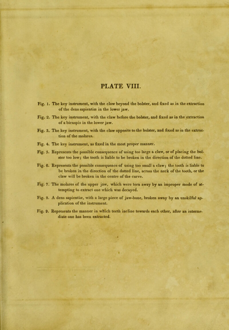 Fig. 1. The key instrument, with the claw beyond the bolster, and fixed as in the extraction of the dens sapientiae in the lower jaw. Fig. 2. The key instrument, with the claw before the bolster, and fixed as in the extraction of a bicuspis in the lower jaw. Fig. 3. The key instrument, with the claw opposite to the bolster, and fixed as in the extrac- tion of the molares. Fig. 4. The key instrument, as fixed in the most proper manner. Fig. 5. Represents the possible consequence of using too large a claw, or of placing the bol- ster too low; the tooth is liable to be broken in the direction of the dotted line. Fig. 6. Represents the possible consequence of using too small a claw; the tooth is liable to be broken in the direction of the dotted line, across the neck of the tooth, or the claw will be broken in the centre of the curve. Fig. 7. The molares of the upper jaw, which were torn away by an improper mode of at- tempting to extract one which was decayed. Fig. 8. A dens sapientim, with a large piece of jaw-bone, broken away by an unskilful ap- plication of the instrument. Fig. 9. Represents the manner in which teeth incline towards each other, after an interme- diate one has been extracted. I
