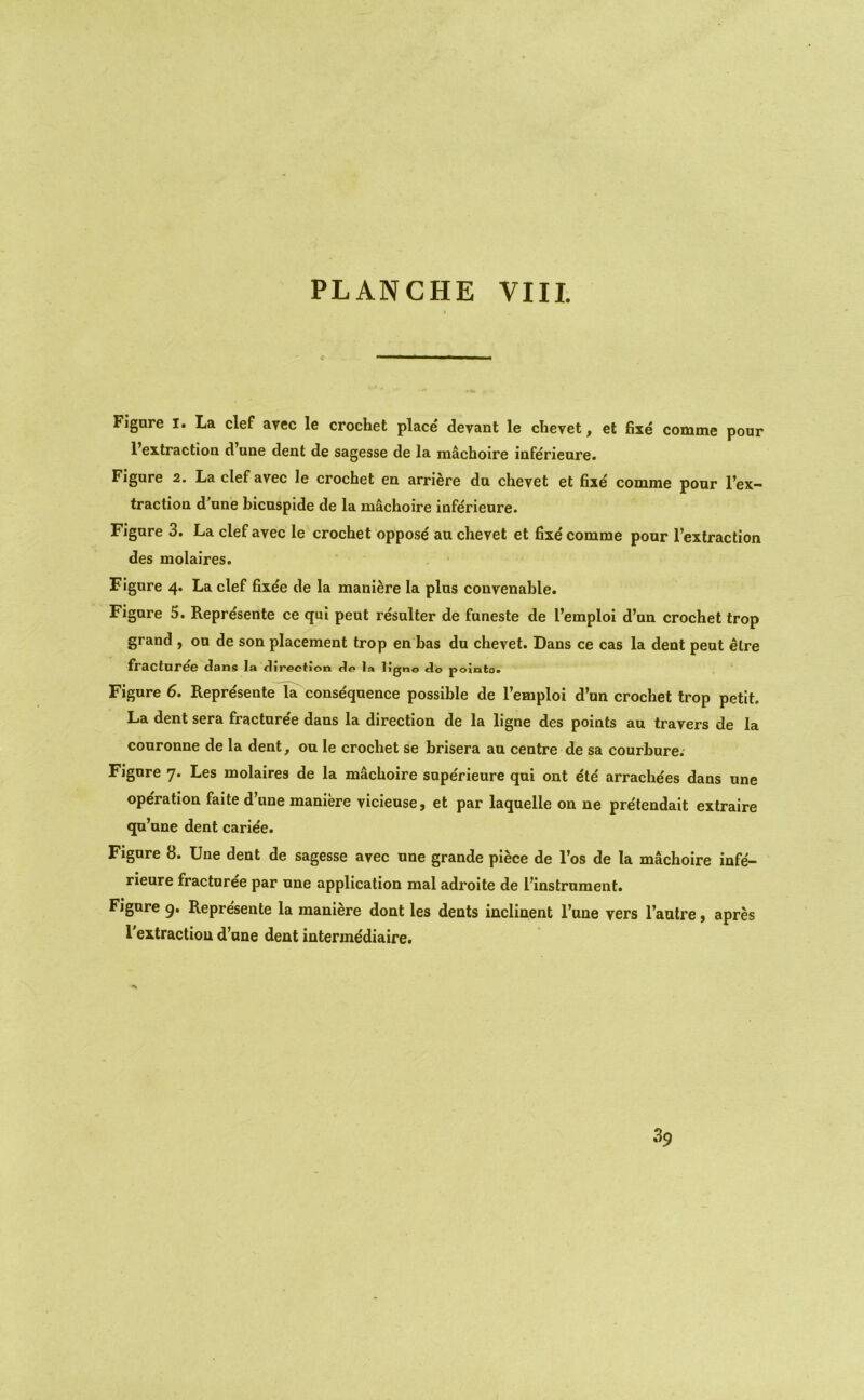 Figare I. La clef avec le crochet place devant le chevet, et fixe comme pour I’extractioQ d une dent de sagesse de la machoire inferieure. Figure 2. La clef avec le crochet en arriere da chevet et fixe comme pour I’ex— traction dune bicuspide de la machoire infe'rienre. Figare 3. La clef avec le crochet oppose au chevet et fixe comme pour I’extraction des molaires. Figare 4. La clef fixee de la maniere la plus convenable. Figare 5. Represente ce qui peat resalter de funeste de I’emploi d’an crochet trop grand , on de son placement trop en has du chevet. Dans ce cas la dent peat ^Ire fVdCtnrCG dans la difeotion de 1a ligno do poiato* Figure 6. Repre'sente la consequence possible de I’emploi d’an crochet trop petit. La dent sera fractaree dans la direction de la ligne des points an travers de la couronne de la dent, oa le crochet se brlsera an centre de sa courbure. Figare 7. Les molaires de la machoire sape'rieure qai ont e'te arrachees dans une operation faite d’une maniere vicieuse, et par laquelle on ne pre'tendait extraire qu’une dent cariee. Figure 8. Une dent de sagesse avec nne grande piece de I’os de la machoire infe- rieure fractaree par une application mal adroite de I’instrament. Figare 9. Represente la maniere dont les dents inclinent I’une vers I’aulre, apres I'extractiou d’ane dent intermediaire.