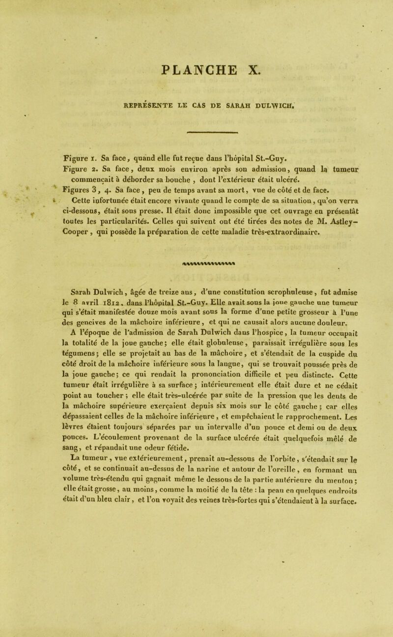 REPRESENTE LE CAS DE SARAH DUL-WICH, Figure i. Sa face, quand elle fut recue dans I’hopital St.-Guy. Figure 2. Sa face, deux mois environ apr^s sou admission, quand la tumeur commencait a deborder sa bouche , dont I’exterieur etait ulcere. ' Figures 3, 4. Sa face , pen de temps avant sa morl, vne de cote et de face. »- Cette infortunee etait encore vivante quand le compte de sa situation, qu’on verra ci-dessons, etait sons presse. 11 etait done impossible que cet ouvrage en preseutat toutes les particularites. Celles qui suivent ont ete tirees des notes de M. Astley- Cooper , qui possede la preparation de cette maladie tres-extraordinairc. Sarah Dulwich, agee de treize aus, d'une constitution scrophnleuse, fut admise Je 8 avril 1812, dans I’hopital St.-Guy. Elle avalt sons la joue gauche une tumeur qui s’^tait manifestee douze mois avant sons la forme d'une petite grosseur a I’une des gencives de la machoire infe'rleure, et qui ne causalt alors aucune douleur. A I’epoque de I'admission de Sarah Dulwich dans I’hospice, la tumeur occupait la totallte de la joue gauche; elle etait globnlense, paraissait irregullere sous les tegumens; elle se projetait an has de la machoire, et s’etendait de la cuspide du cote droit de la machoire inferieure sous la langne, qui se trouvait poussee pres de la joue gauche; ce qui rendait la prononciation difficile et peu distincte. Cette tumeur etait irreguliere a sa surface; interieurement elle etait dure et ne cedait point au toucher; elle etait tres-ulceree par suite de la pression que les dents de la machoire supe'rienre exercalent depuis six mois sur le cote gauche; car elles depassaient celles de la machoire inferieure, et empechaient le rapprochement. Les l^vres etaient toujours separees par un intervalle d’un ponce et demi ou de deux ponces. L’e'coulement provenant de la surface ulceree etait quelquefois mele de sang, et repandait une odeur fetide. La tumeur , vue exterieurement, prenalt au-dessons de I’orbite, s'etendait sur le cot^, et se continualt au-dessus de la narine et autour de I’oreille , en formant un volume trb-etendu qui gagnait meme le dessous de la partie ante'rienre du menton ; elle etait grosse, au moins, comme la moltie de la tete : la pean en quelques enclroits etait d’un bleu clair, et Ton voyait des veines tres-forles qui s’dtendaieut a la surface.