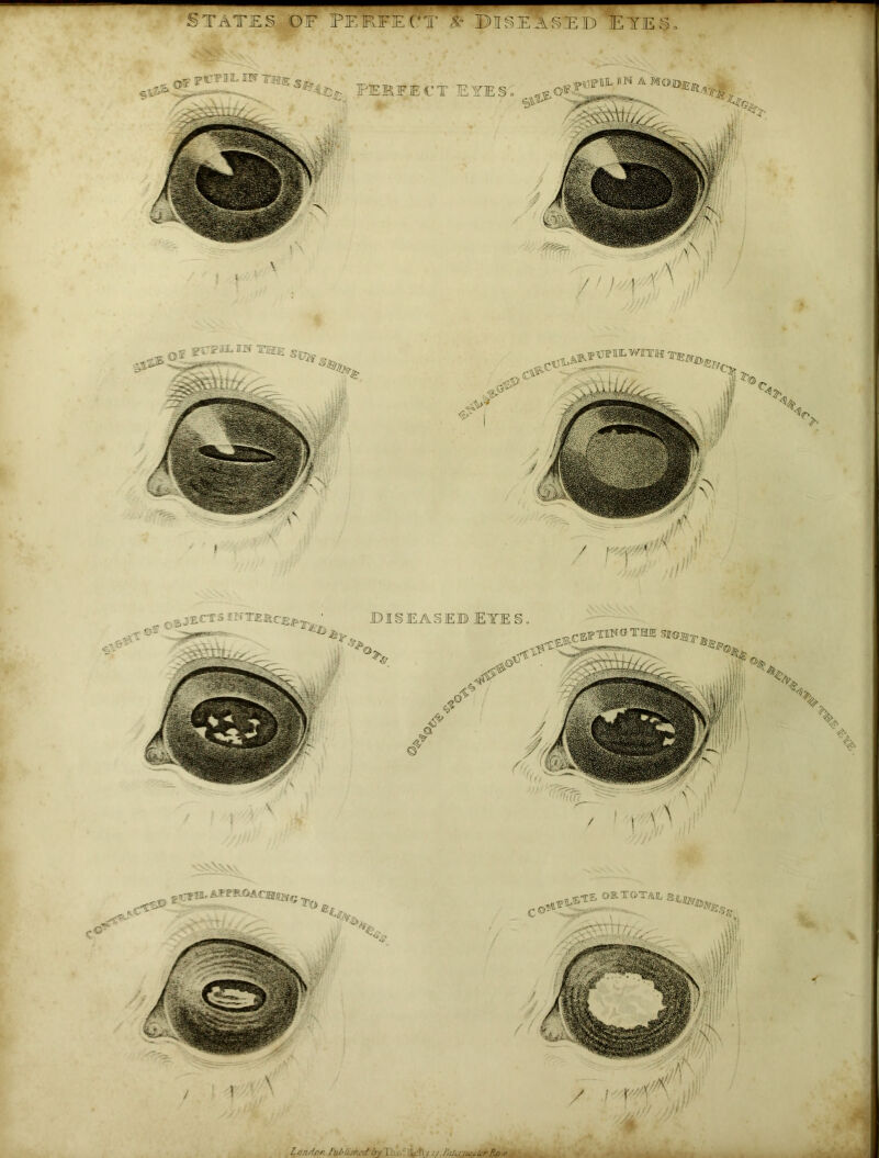 ■ States of fekftett * Diseased eie§„ PEBFEt’T EYES., </<p\ * „ ejects inure, diseased Eyes,