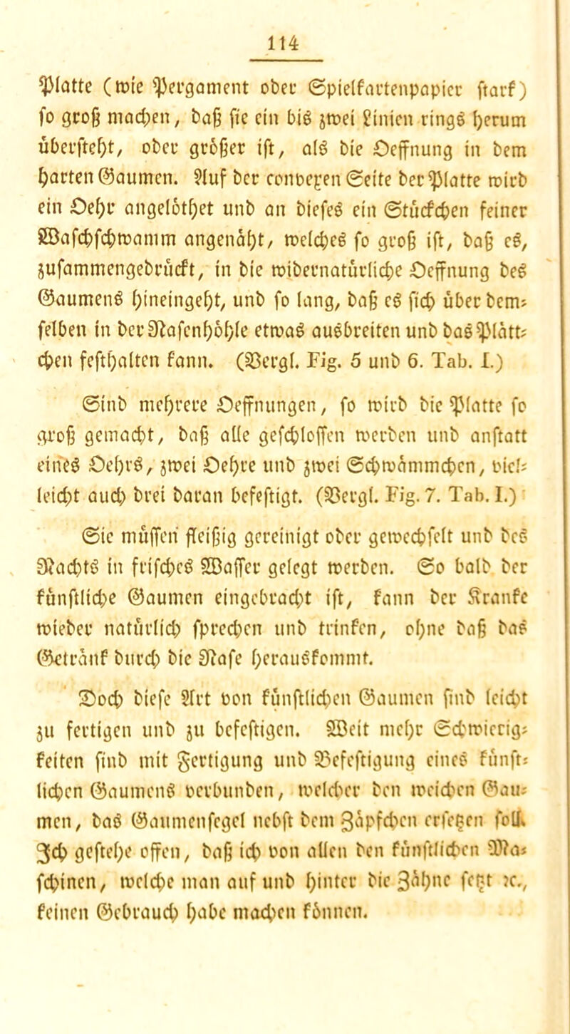 glatte (rote Pergament ober ©pielfartenpapicr ftarf) fo groß macßen, baß fie ein big Etnien ringg ßerum überfteßt, ober großer iff, alg bie Oeffnung in bem garten ©aumen. ?luf bcc conoepen ©eite berglatte trieb ein Oeßr angelotßet iittb an biefe© ein ©tücfcßen feiner Söafcßfcßwanim angenaßt, roeId;e6 fo groß ift, baß eg, jufammengebrüeft, in bie roibernaturlicf>e Oeffnung beg ©aumeng ßineingeßt, unb fo lang, baß cg fieß über berm felben in berSßafenßoßle etwag auebreiten unb bae^Matfc eßen feftßalten f'ann. (33ergl. Fig. 5 unb 6. Tab. I.) ©tnb nteßrere Oeffnungen, fo tßirb bie glatte fo groß gemaeßt, baß alle gefcßloffcn werben unb anftatt ein eg Oeßrg, jwet Oeßre unb jwei ©eßwammeßen, rief; leießt aueß brei baran ßefeftigt. (23ergl. Fig. 7. Tab. I.) ©ic muffen fleißig gereinigt ober gewecßfelt unb bcS Siacßtg in frifeßeg SBaffer gelegt werben, ©o halb ber fanffltcße ©aumen eingebraeßt ift, fann ber Äranfe wieber natürlicß fpreeßen unb trinfen, oßne baß ba? ©etrauf bnreß bie Sftafe ßeraugfommt. SDocß biefe 2lrt bon fünffließen ©aumen ffnb leießt ju fertigen unb ju befeffigen. Söeit meße ©eßwieeig; feiten finb mit gertigung unb S5efeffigung eineg Fünft: ließen ©aumeng perbunben, welcßer ben weießen ©am men, bag ©aumenfegcl nebft bem güpfeßen erleben foll» 3cß gefteße offen, baß icß pon allen ben fünftließcn üfta» feßinen, tuclcße man auf unb ßintcr bi&3^ßnc ff£t Jcv feinen ©ebraueß ßabe macßen fbnnen.