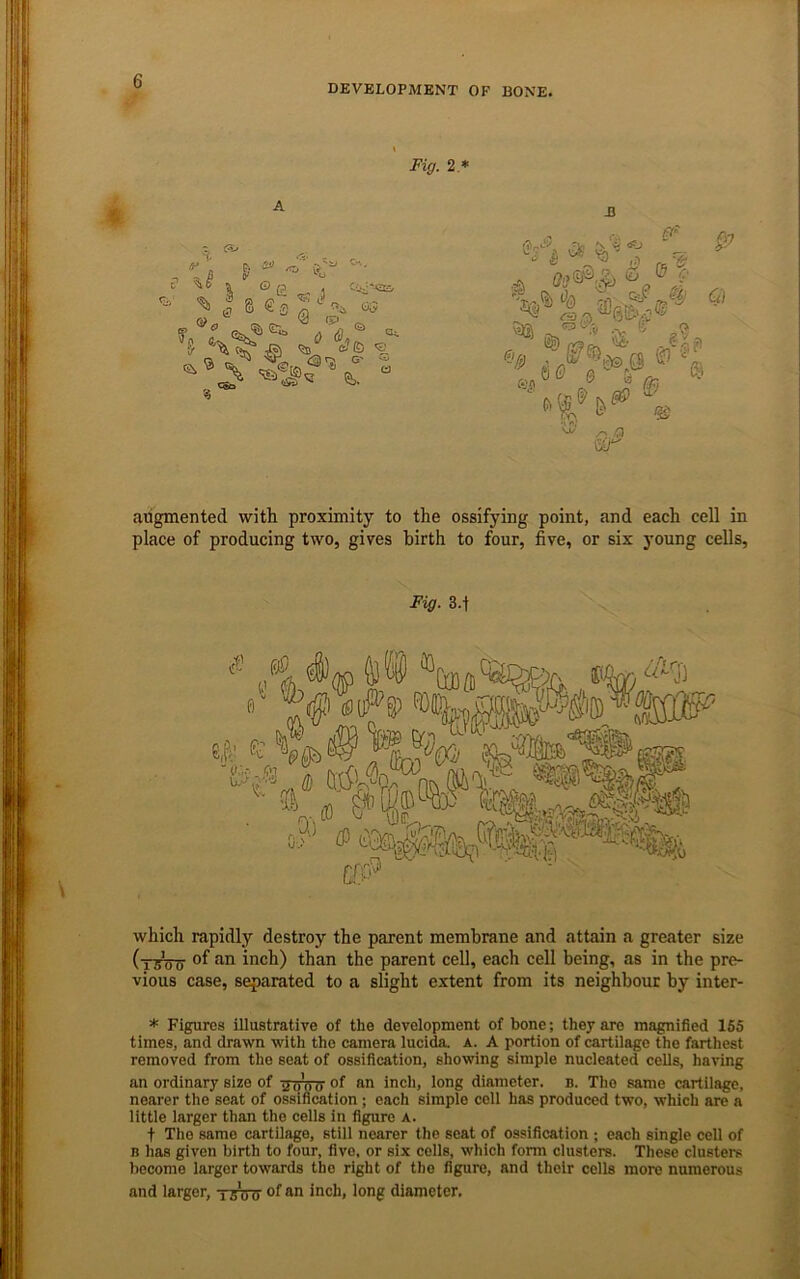 DEVELOPMENT OF BONE. Fiff. 2 * A % as © e 8 €.3 •J (Ss % ^ i} . Cn, o;5 \ <3 (p^ cJ© « <2i) rj G' S (b. JJ Q augmented with proximity to the ossifying point, and each cell in place of producing two, gives birth to four, five, or six young cells. Fig. 3.1 which rapidly destroy the parent membrane and attain a greater size (ttcTo inch) than the parent cell, each cell being, as in the pre- vious case, separated to a slight extent from its neighbour by inter- * Figures illustrative of the development of bone; they are magnified 155 times, and drawn with the camera lucida. a. A portion of cartilage the farthest removed from the seat of ossification, showing simple nucleated cells, having an ordinary size of ‘jiigd of <>■0 inch, long diameter, b. The same cartilage, nearer the seat of ossification; each simple cell has produced two, which are a little larger than the cells in figure a. t The same cartilage, still nearer the seat of ossification ; each single cell of B has given birth to four, five, or six cells, which form clusters. These clusters become larger towards the right of the figure, and their cells more numerous and larger, tsW of ^och, long diameter.