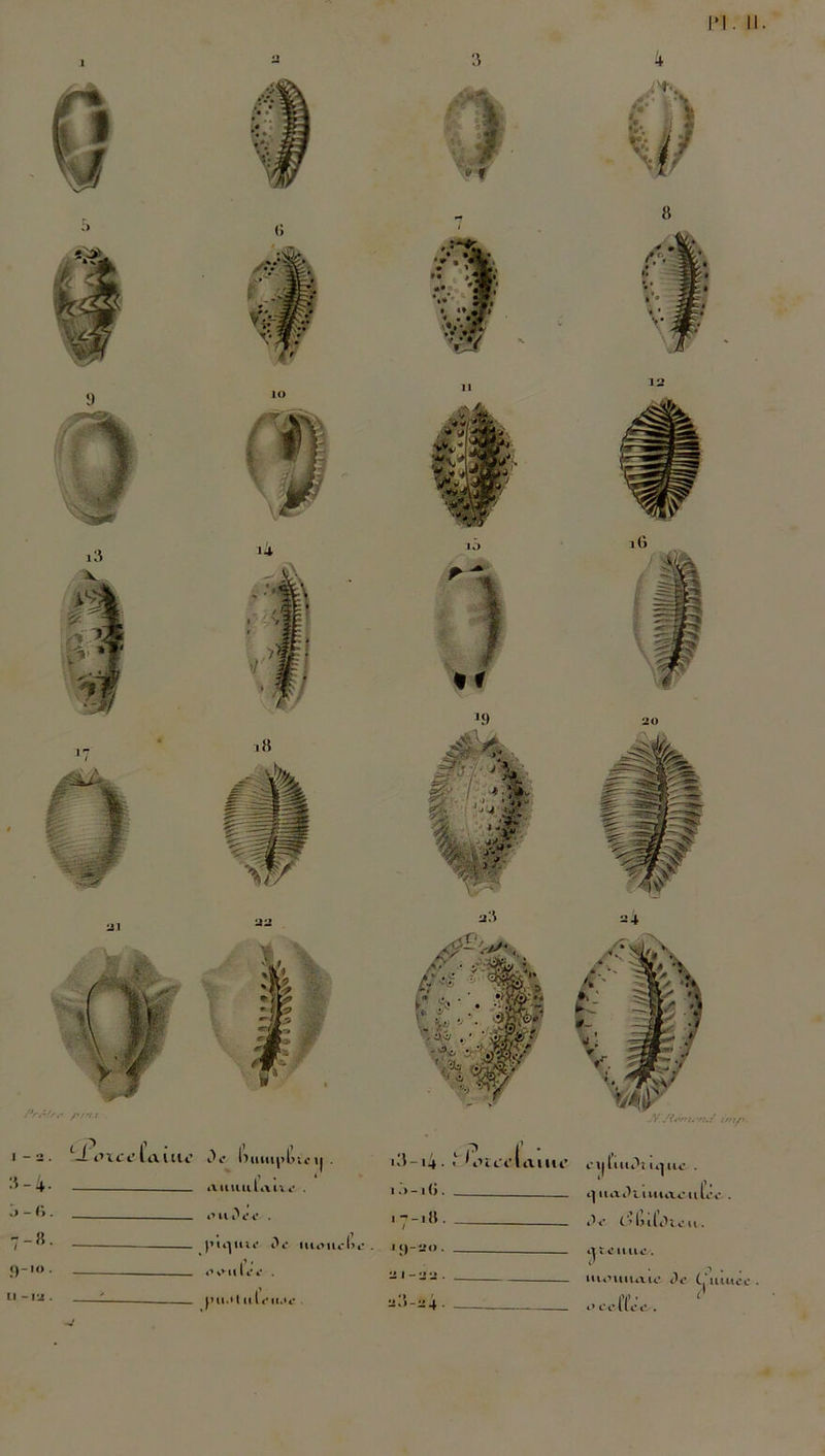 3-4. o - 6. <)-10 . . annulant- . l’Ut't’l’ . — pupille De uiouel’e . f s» u I e e . - pu.'I n I<-n.il- 3 1 . : 1 - 2 -j . 4 JV./i(W/< va/ im/*. eiiLuDî ram- . ‘ - I’- e|naDtiuiaeuL'e . De (. -1)ilDte u . t eune . monnaie De muec . oeelïee. u -vj . a.1-^4