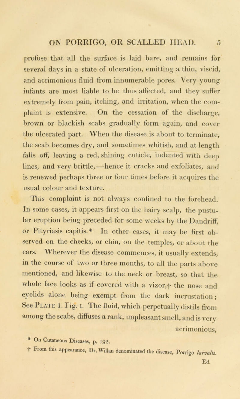 profuse that all the surface is laid bare, and remains for several days in a state of ulceration, emitting a thin, viscid, and acrimonious fluid from innumerable pores. Very young- infants are most liable to be thus affected, and they suffer extremely from pain, itching, and irritation, when the com- plaint is extensive. On the cessation of the discharge, brown or blackish scabs gradually form again, and cover the ulcerated part. When the disease is about to terminate, the scab becomes dry, and sometimes whitish, and at length falls off, leaving a red, shining cuticle, indented with deep lines, and very brittle,—hence it cracks and exfoliates, and is rencAved perhaps three or four times before it acquires the usual colour and texture. This complaint is not ahvays confined to the forehead. In some cases, it appears first on the hairy scalp, the pustu- lar eruption being preceded for some weeks by the Dandriff, or Pityriasis capitis.* In other cases, it may be first ob- served on the cheeks, or chin, on the temples, or about the ears. Wherever the disease commences, it usually extends, in the course of two or three months, to all the parts above mentioned, and likewise to the neck or breast, so that the whole face looks as if covered Avith a vizor,f the nose and eyelids alone being exempt from the dark incrustation; See Plate 1. Fig. i. The fluid, Avhich perpetually distils from among the scabs, diffuses a rank, unpleasant smell, and is very acrimonious, * On Cutaneous Diseases, p. 1Q2. t From this appearance. Dr. Willan denominated the disease, Porrigo larvalis. Ed.