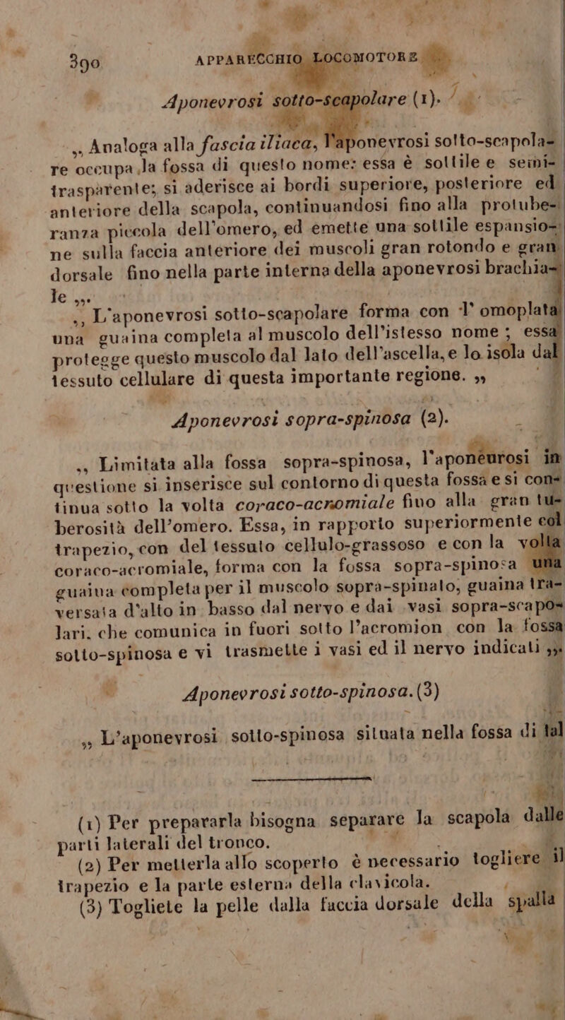 de tr: pi j x) è x Mi sg e; MT % x î p Aponevrosi i lare: (1)../,ffC- 390 APPA sa . Na; doi 199 ida 19 , Analoga alla fascia iliaca, l'aponevrosi sotto-scapola= re occupa Ja fossa di questo nome: essa è sollile e seini- trasparente; si aderisce ai bordi superiore, posteriore ed. anteriore della scapola, continuandosi fino alla protube-. ranza piccola dell’omero, ed emette una sottile espansio= ne sulla faccia anteriore dei muscoli gran rotondo e gran dorsale fino nella parte interna della aponevrosi brachia= le 99 i ° . DI ‘ ,, L'aponevrosi sotto-scapolare forma con 1 omoplat una guaina completa al muscolo dell’istesso nome ; esse i 3 protegge questo muscolo dal lato dell ascella, e lo. isola da iessuto cellulare di questa importante regione. ,» °D ve Aponevrosi sopra-spinosa (2). 4 ,s Limitata alla fossa sopra-spinosa, l'aponèurosi in questione si inserisce sul contorno di questa fossa e si con tina sotto la volta coraco-acnomiale fivo alla. gran tie berosità dell’omero. Essa, in rapporto superiormente col trapezio, con del tessuto cellulo-grassoso e con lav la coraco-acromiale, forma con la fossa sopra-spinosa Bi: guaiva completa per il muscolo sopra-spinalo, guaina tra= versata d'alto in basso dal nervo e dai .vasi sopra-sca pos lari. che comunica in fuori sotto l’acromion con la fossa solio-spinosa e vi trasmette i vasì ed il nervo indicali 3. si Aponevrosi sotto-spinosa.(3) di ; i ,s L'aponevrosi sotlo-spinosa situata nella fossa di tal sei 441 i | (77 00 (1) Per prepararla bisogna separare la scapola dalle parti laterali del tronco. sii MO JI (2) Per metterla allo scoperto è necessario togliere il irapezio e la parte esterna della clavicola. 1