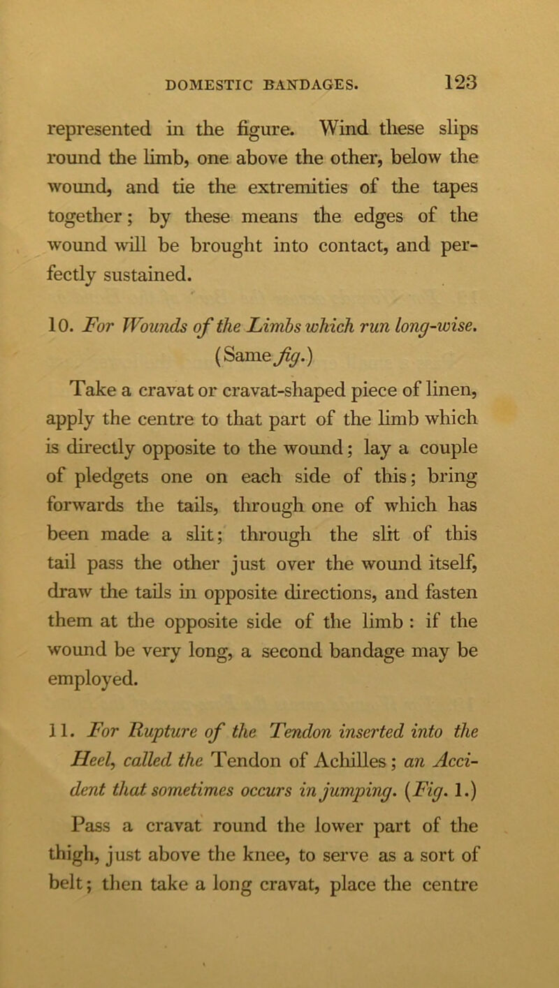 represented in the figure. Wind these slips round the limb, one above the other, below the wound, and tie the extremities of the tapes together; by these means the edges of the wound will be brought into contact, and per- fectly sustained. 10. For Wounds of the Limbs which run long-wise. (Same/y.) Take a cravat or cravat-shaped piece of linen, apply the centre to that part of the limb which is directly opposite to the wound; lay a couple of pledgets one on each side of this; bring forwards the tads, through one of which has been made a slit; through the slit of this tail pass the other just over the wound itself, draw the tads in opposite directions, and fasten them at the opposite side of the limb : if the wound be very long, a second bandage may be employed. 11. For Rupture of the Tendon inserted into the Heel, called the Tendon of Achilles; an Acci- dent that sometimes occurs in jumping. {Fig. 1.) Pass a cravat round the lower part of the thigh, just above the knee, to serve as a sort of belt; then take a long cravat, place the centre