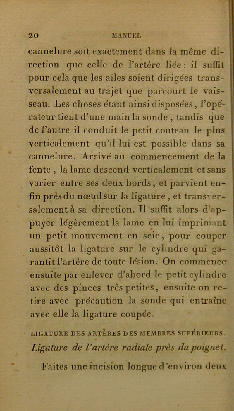 cannelure soit exactement dans ia même di- rection que celle de l’artère lie'e : il suffit pour cela que les ailes soient dirigées trans- versalement au trajet que parcourt le vais- seau. Les choses e'tant ainsi disposées, l’opé- rateur tient d’une main la sonde , tandis que de l’autre il conduit le petit couteau le plus verticalement qu’il lui est possible dans sa cannelure. Arrive' au commencement de la fente , la lame descend verticalement et sans varier entre ses deux bords, et parvient en- fin près du nœud sur la ligature , et transver- salement à sa direction. Il suffit alors d’ap- puyer le'gèrement la lame en lui imprimant un petit mouvement en scie, pour couper aussitôt la ligature sur le cylindre qui ga- rantit l’artère de toute lésion. On commence ensuite par enlever d’abord le petit cylindre avec des pinces très petites, ensuite on re- tire avec précaution la sonde qui entraîne avec elle la ligature coupée. LIGATURE DES ARTERES DES MEMBRES SUPERIEURS. Ligature de Vartère radiale près du poignet. Faites une incision longue d’environ deux