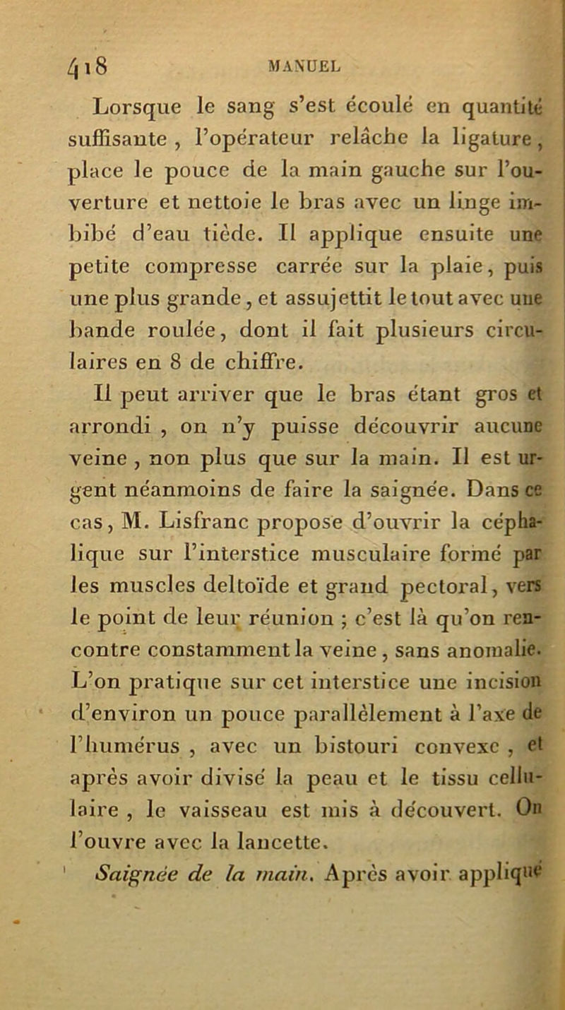 Lorsque le sang s’est écoulé en quantité suffisante , l’opérateur relâche la ligature, place le pouce de la main gauche sur l’ou- verture et nettoie le bras avec un linge im- bibé d’eau tiède. II applique ensuite une petite compresse carrée sur la plaie, puis une plus grande, et assujettit le tout avec uue bande roulée, dont il fait plusieurs circu- laires en 8 de chiffre. Il peut arriver que le bras étant gros et arrondi , on n’y puisse découvrir aucune veine , non plus que sur la main. Il est ur- gent néanmoins de faire la saignée. Dans ce cas, M. Lisfranc propose d’ouvrir la cépha- lique sur l’interstice musculaire formé par les muscles deltoïde et grand pectoral, vers le point cle leur réunion ; c’est là qu’on ren- contre constamment la veine , sans anomalie. L’on pratique sur cet interstice une incision d’environ un pouce parallèlement à l’axe de l’humérus , avec un bistouri convexe , et après avoir divisé la peau et le tissu cellu- laire , le vaisseau est mis à découvert. On l’ouvre avec la lancette. Saignée de la main. Après avoir appliqué