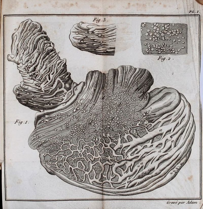 PLl. Orccoe par Adani ■ '/