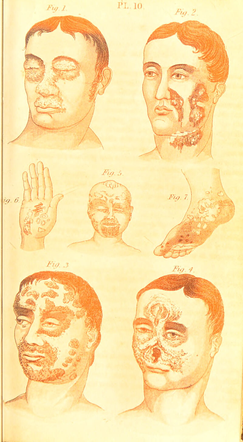 IM. ]() /v</. i'. /■Vy I /'W .3