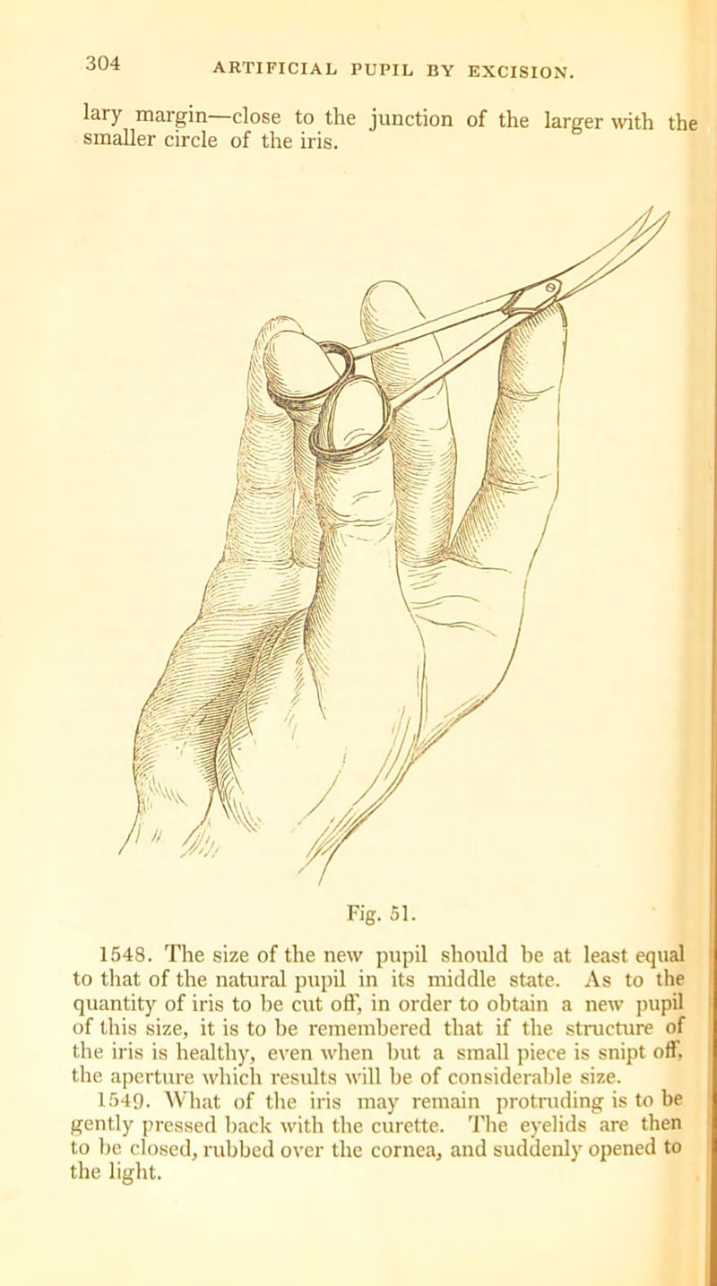 lary margin close to the junction of the larger with the smaller circle of the iris. 1548. The size of the new pupil should he at least equal to that of the natural pupil in its middle state. As to the quantity of iris to be cut off, in order to obtain a new pupil of this size, it is to be remembered that if the structure of the iris is healthy, even when but a small piece is snipt off. the aperture which results will be of considerable size. 1549. What of the iris may remain protruding is to be gently pressed back with the curette. The eyelids are then to be closed, rubbed over the cornea, and suddenly opened to the light.