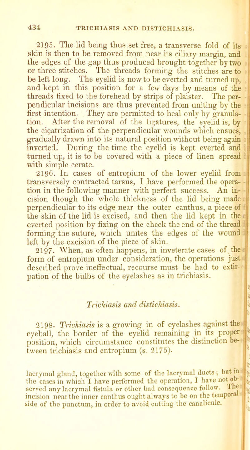 2195. The lid being thus set free, a transverse fold of its skin is then to be removed from near its ciliary margin, and the edges of the gap thus produced brought together by two or three stitches. The threads forming the stitches are to be left long. The eyelid is now to he everted and turned up, and kept in this position for a few days by means of the threads fixed to the forehead by strips of plaister. The per- pendicidar incisions are thus prevented from uniting by the first intention. They are permitted to heal only by granula- tion. After the removal of the ligatures, the eyelid is, by the cicatrization of the perpendicular wounds which ensues, gradually drawn into its natural position without being again inverted. During the time the eyelid is kept everted and turned up, it is to be covered with a piece of linen spread with simple cerate. 2196. In cases of entropium of the lower eyelid from transversely contracted tarsus, I have performed the opera- tion in the following manner with perfect success. An in- cision though the whole thickness of the lid being made i! perpendicular to its edge near the outer canthus, a piece of ! the skin of the lid is excised, and then the lid kept in the everted position by fixing on the cheek the end of the thread forming the suture, which unites the edges of the wound ( left by the excision of the piece of skin. 2197. When, as often happens, in inveterate cases of the form of entropium under consideration, the operations just described prove ineffectual, recourse must be had to extir- pation of the bulbs of the eyelashes as in trichiasis. Trichiasis and distichiasis. 2198. Trichiasis is a growing in of eyelashes against the ! eyeball, the border of the eyelid remaining in its proper ' < position, which circumstance constitutes the distinction be- tween trichiasis and entropium (s. 2175)- lacrymal gland, together with some of the lacrymal ducts ; hut in the cases in which I have performed the operation, I have not ob- served any lacrymal fistula or other bad consequence follow. The incision near the inner canthus ought always to be on the temporal side of the punctual, in order to avoid cutting the canalicule. $ 5; It ; h