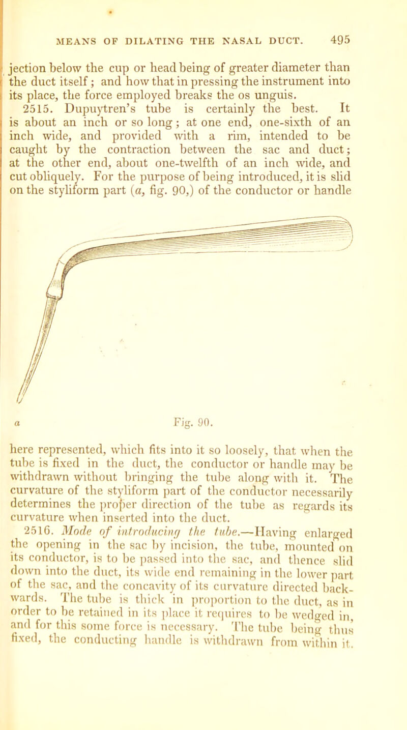 jection below the cup or head being of greater diameter than the duct itself; and how that in pressing the instrument into its place, the force employed breaks the os unguis. 2515. Dupuytren’s tube is certainly the best. It is about an inch or so long; at one end, one-sixth of an inch wide, and provided with a rim, intended to be caught by the contraction between the sac and duct; at the other end, about one-twelfth of an inch wide, and cut obliquely. For the purpose of being introduced, it is slid on the styliform part (a, fig. 90,) of the conductor or handle here represented, which fits into it so loosely, that when the tube is fixed in the duct, the conductor or handle may be withdrawn without bringing the tube along with it. The curvature of the styliform part of the conductor necessarily determines the proper direction of the tube as regards its curvature when inserted into the duct. 2516. Mode of introducing the tube.— I laving enlarged the opening in the sac by incision, the tube, mounted on its conductor, is to be passed into the sac, and thence slid down into the duct, its wide end remaining in the lower part of the sac, and the concavity of its curvature directed back- wards. The tube is thick in proportion to the duct, as in order to be retained in its place it requires to lie wedged in, and for this some force is necessary. The tube being thus fixed, the conducting handle is withdrawn from within it.