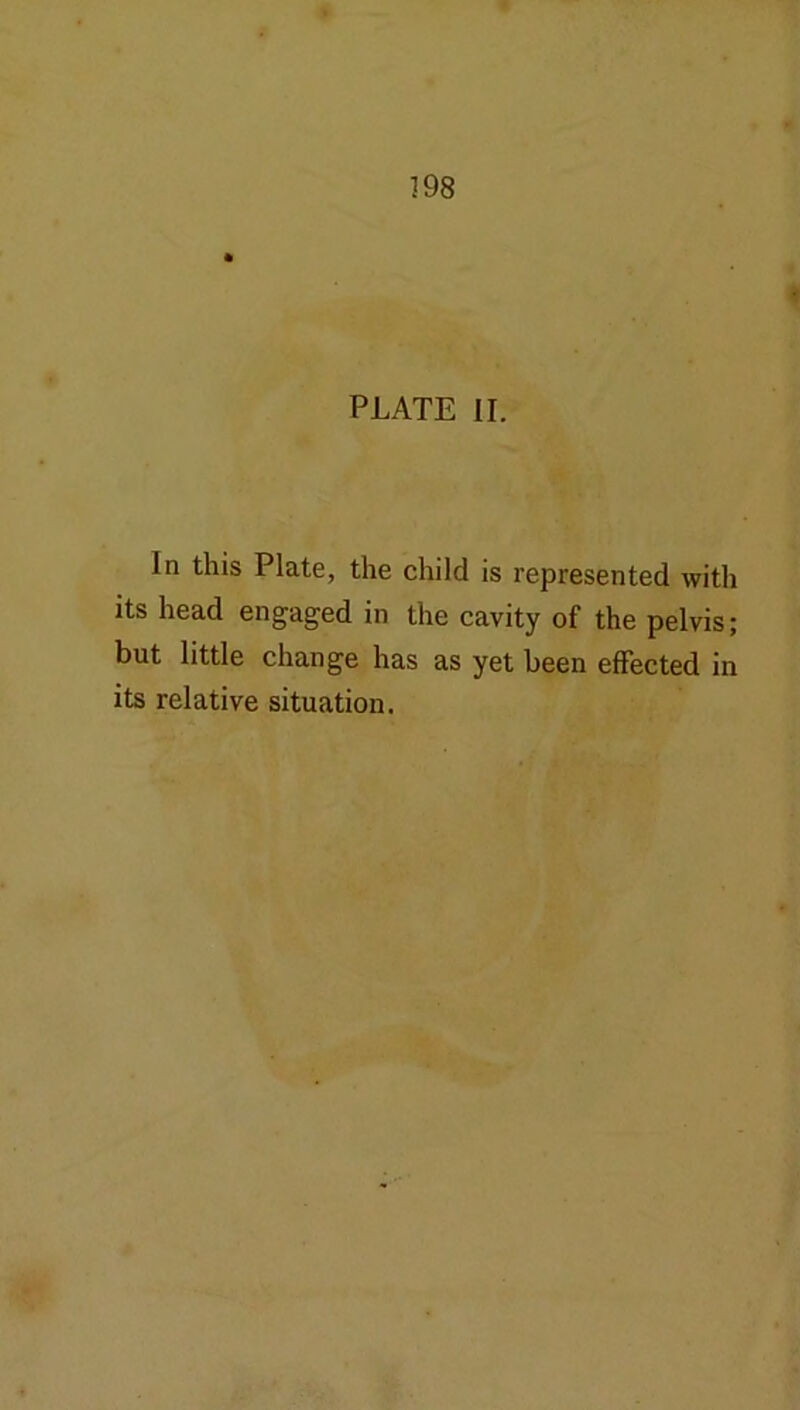 198 i PLATE II. In this Plate, the child is represented with its head engaged in the cavity of the pelvis; but little change has as yet been effected in its relative situation.