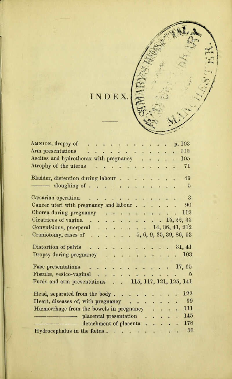 I I Amnion, dropsy of p. 103 Arm presentations 113 Ascites and hydrotliorax with pregnancy ..... 105 Atrophy of the uterus 71 Bladder, distention during labour 49 sloughing of 5 Caesarian operation 3 Cancer uteri with pregnancy and labour 90 Chorea during pregnancy 112 Cicatrices of vagina 15, 22, 35 Convulsions, puerperal ....... 14, 36, 41, 212 Craniotomy, cases of . . , . . . 5, 6, 9, 35,39, 86, 93 Distortion of pelvis 31, 41 Dropsy during pregnancy 103 Face presentations 17, 65 Fistuloe, vesico-vaginal 5 Funis and arm presentations . . 115, 117, 121, 125, 141 Head, separated from the body 122 Heart, diseases of, with pregnancy 99 Haemorrhage from the bowels in pregnancy .... Ill placental presentation 145 detachment of placenta 178 Hydrocephalus in the foetus 56 J