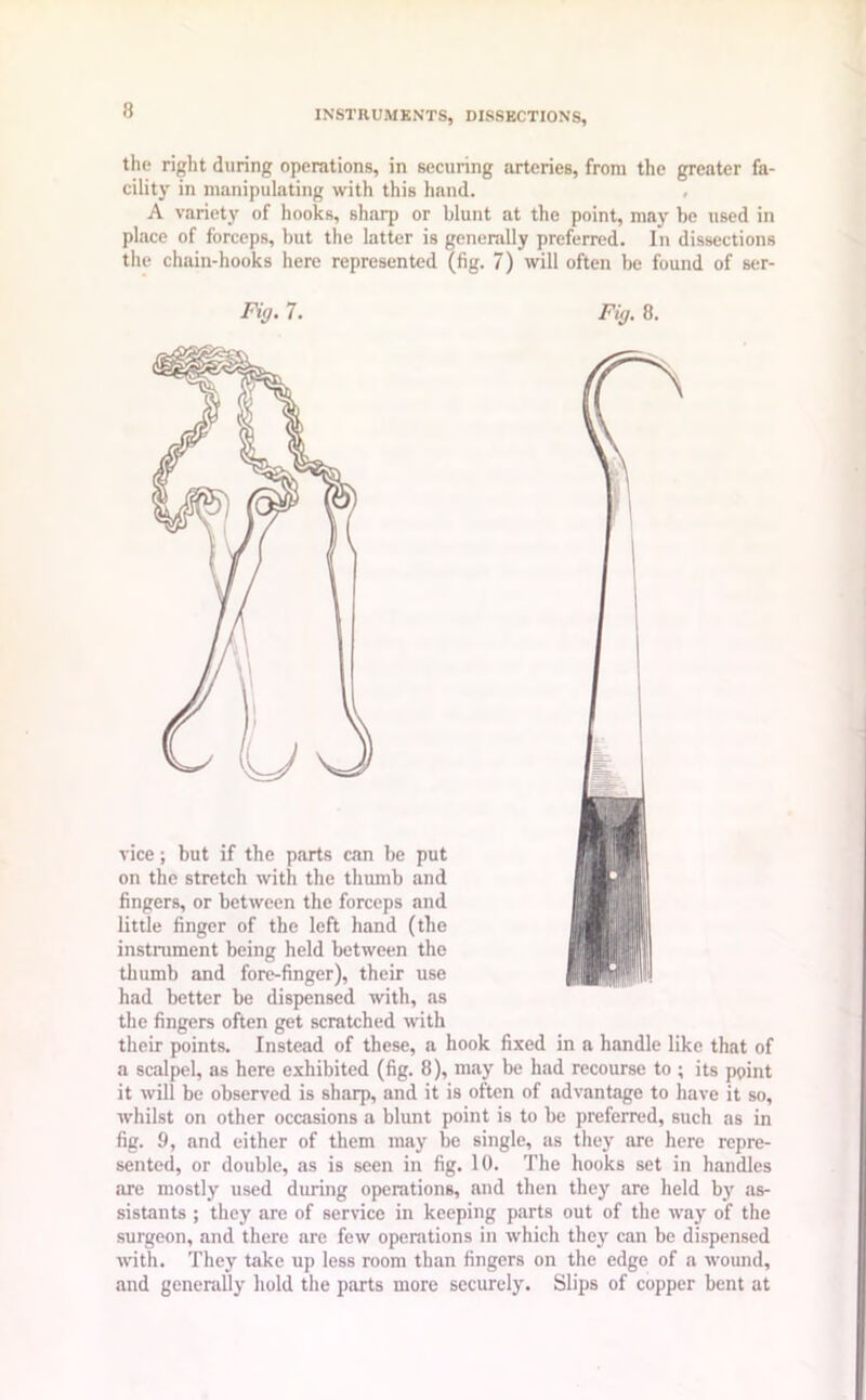 the right during operations, in securing arteries, from the greater fa- cility in manipulating with this hand. A variety of hooks, sharp or blunt at the point, may be used in place of forceps, but the latter is generally preferred. In dissections the chain-hooks here represented (fig. 7) will often be found of ser- Fig. 7. Fig. 8. vice; but if the parts can be put on the stretch with the thumb and fingers, or between the forceps and little finger of the left hand (the instrument being held between the thumb and fore-finger), their use had better be dispensed with, as the fingers often get scratched with their points. Instead of these, a hook fixed in a handle like that of a scalpel, as here exhibited (fig. 8), may be had recourse to ; its point it will be observed is sharp, and it is often of advantage to have it so, whilst on other occasions a blunt point is to be preferred, such as in fig. 9, and either of them may be single, as they are here repre- sented, or double, as is seen in fig. 10. The hooks set in handles are mostly used during operations, and then they are held by as- sistants ; they are of service in keeping parts out of the way of the surgeon, and there are few operations in which they can be dispensed with. They take up less room than fingers on the edge of a wound, and generally hold the parts more securely. Slips of copper bent at