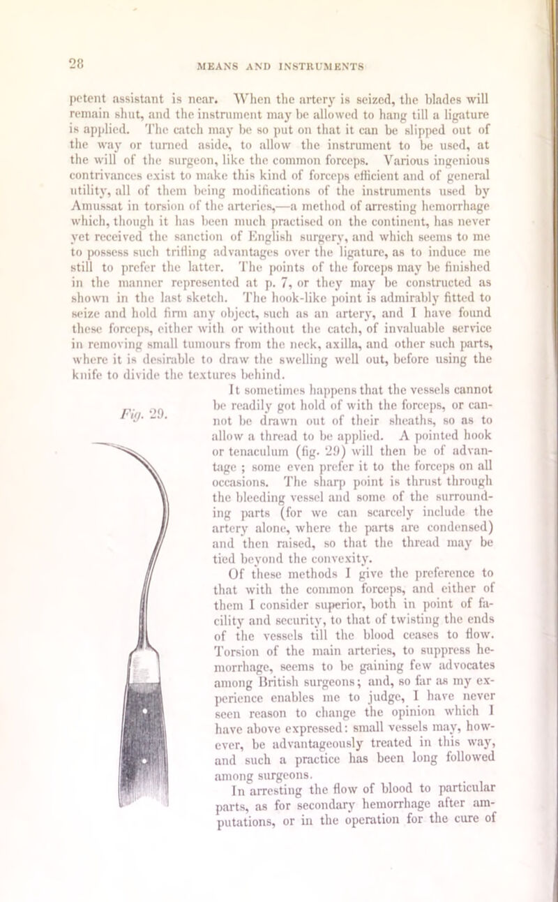 petent assistant is near. When the artery is seized, the blades will remain shut, and the instrument may be allowed to hang till a ligature is applied. The catch may be so put on that it can be slipped out of the way or turned aside, to allow the instrument to be used, at the will of the surgeon, like the common forceps. Various ingenious contrivances exist to make this kind of forceps efficient and of general utility, all of them being modifications of the instruments used by Amussat in torsion of the arteries,—a method of arresting hemorrhage which, though it has been much practised on the continent, has never yet received the sanction of English surgery, and which seems to me to possess such trifling advantages over the ligature, as to induce me still to prefer the latter. The points of the forceps may be finished in the manner represented at p. 7, or they may be constructed as shown in the last sketch. The hook-like point is admirably fitted to seize and hold firm any object, such as an artery, and I have found these forceps, either with or without the catch, of invaluable service in removing small tumours from the neck, axilla, and other such parts, where it is desirable to draw the swelling well out, before using the knife to divide the textures behind. It sometimes happens that the vessels cannot be readily got hold of with the forceps, or can- not be drawn out of their sheaths, so as to allow a thread to be applied. A pointed hook or tenaculum (fig. 29) will then be of advan- tage ; some even prefer it to the forceps on all occasions. The sharp point is thrust through the bleeding vessel and some of the surround- ing parts (for we can scarcely include the artery alone, where the parts are condensed) and then raised, so that the thread may be tied beyond the convexity. Of these methods I give the preference to that with the common forceps, and either of them I consider superior, both in point of fa- cility and security, to that of twisting the ends of the vessels till the blood ceases to flow. Torsion of the main arteries, to suppress he- morrhage, seems to be gaining few advocates among British surgeons; and, so far as my ex- perience enables me to judge, I have never seen reason to change the opinion which I have above expressed: small vessels may, how- ever, be advantageously treated in this way, and such a practice has been long followed among surgeons. I n arresting the flow of blood to particular parts, as for secondary hemorrhage after am- putations, or in the operation for the cure of