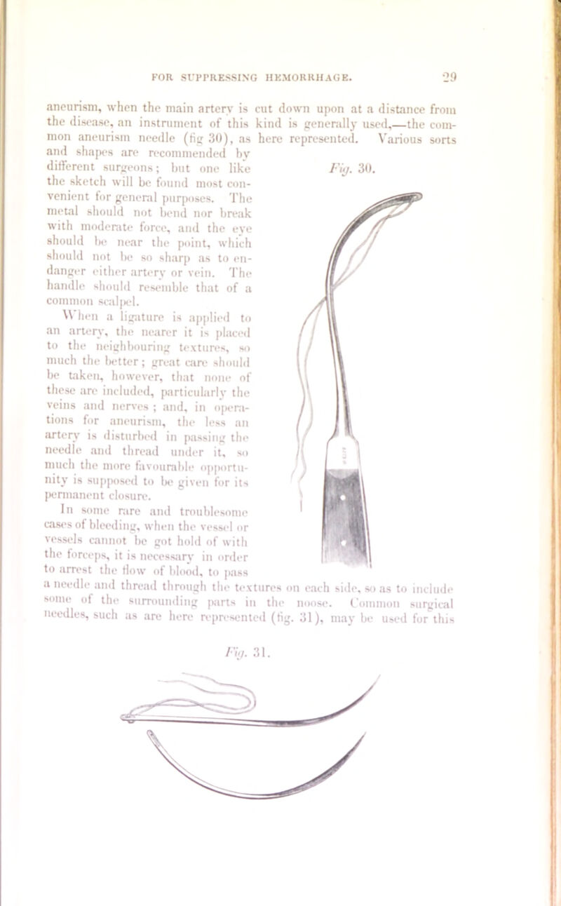 Fig. 30. aneurism, when the main artery is cut down upon at a distance from the disease, an instrument of this kind is generally used,—the com- mon aneurism needle (fig 30), as here represented. Various sorts and shapes are recommended bv different surgeons; but one like the sketch will be found most con- venient for general purposes. The metal should not bend nor break with moderate force, and the eye should be near the point, which should not be so sharp as to en- danger either artery or vein. The handle should resemble that of a common scalpel. When a ligature is applied to an artery, the nearer it is placed to the neighbouring textures, so much the better; great care should be taken, however, that none of these are included, particularly the veins and nerves ; and, in opera- tions for aneurism, the less an artery is disturbed in passing the needle and thread under it, so much the more favourable opportu- nity is supposed to be given for its permanent closure. In some rare and troublesome cases of bleeding, when the vessel or vessels cannot be got hold of with the forceps, it is necessary in order to arrest the flow of blood, to pass a needle and thread through the textures on each side, so as to iududi some of the surrounding parts in the noose. Common surgica needles, such as are here represented (fig. 31), may be used for thi Fig. 31.