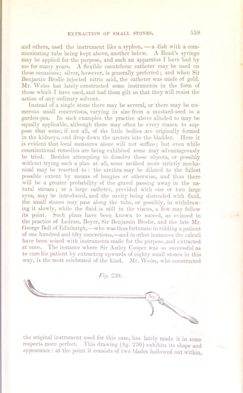 EXTRACTION OF SMALL STONES. 539 and others, used the instrument like a syphon, — a dish with a com- municating tube being kept above, another below. A Read’s syringe may be applied for the purpose, and such an apparatus I have had by me for many years. A flexible caoutchouc catheter may be used on these occasions; silver, however, is generally preferred; and when Sir Benjamin Brodie injected nitric .acid, the catheter was made of gold. Mr. Weiss has lately constructed some instruments in the form of those which I have used, and had them gilt so that they will resist the action of any ordinary solvent. Instead of a single stone there may be several, or there may be nu- merous small concretions, varying in size from a mustard-seed to a garden-pea. In such examples the practice above alluded to may lie equally applicable, although there may often be every reason to sup- pose that some, if not all, of the little bodies are originally formed in the kidneys, and drop down the ureters into the bladder. Here it is evident that local measures alone will not suffice; but even while constitutional remedies are being exhibited some may advantageously be tried. Besides attempting to dissolve these objects, or possibly without trying such a plan at all, some method more strictly mecha- nical may be resorted to ; the urethra may be dilated to the fullest possible extent by means of bougies or otherwise, and thus there will be a greater probability of the gravel passing away in the na- tural stream; or a large catheter, provided with one or two large eyes, may lie introduced, and the cavity being distended with fluid, the small stones may pass along the tube, or possibly, in withdraw- ing it slowly, while the fluid is still in the viscus, a few may follow its point. Such plans have been known to suceed, as evinced in the practice of Ledran, Boyer, Sir Benjamin Brodie, and the late Mr. George Bell of Edinburgh,—who was thus fortunate in ridding a patient of one hundred and fifty concretions,—and in other instances the calculi have been seized with instruments made for the purpose, and extracted at once. The instance where Sir Astley Cooper was so successful as to cure his patient by extracting upwards of eighty small stones in this way, is the most celebrated of the kind. Mr. Weiss, who constructed the original instrument used for this case, has lately made it in some respects more perfect. This drawing (tig. 230) exhibits its shape and appearance: at the point it consists of two blades hollowed out within,
