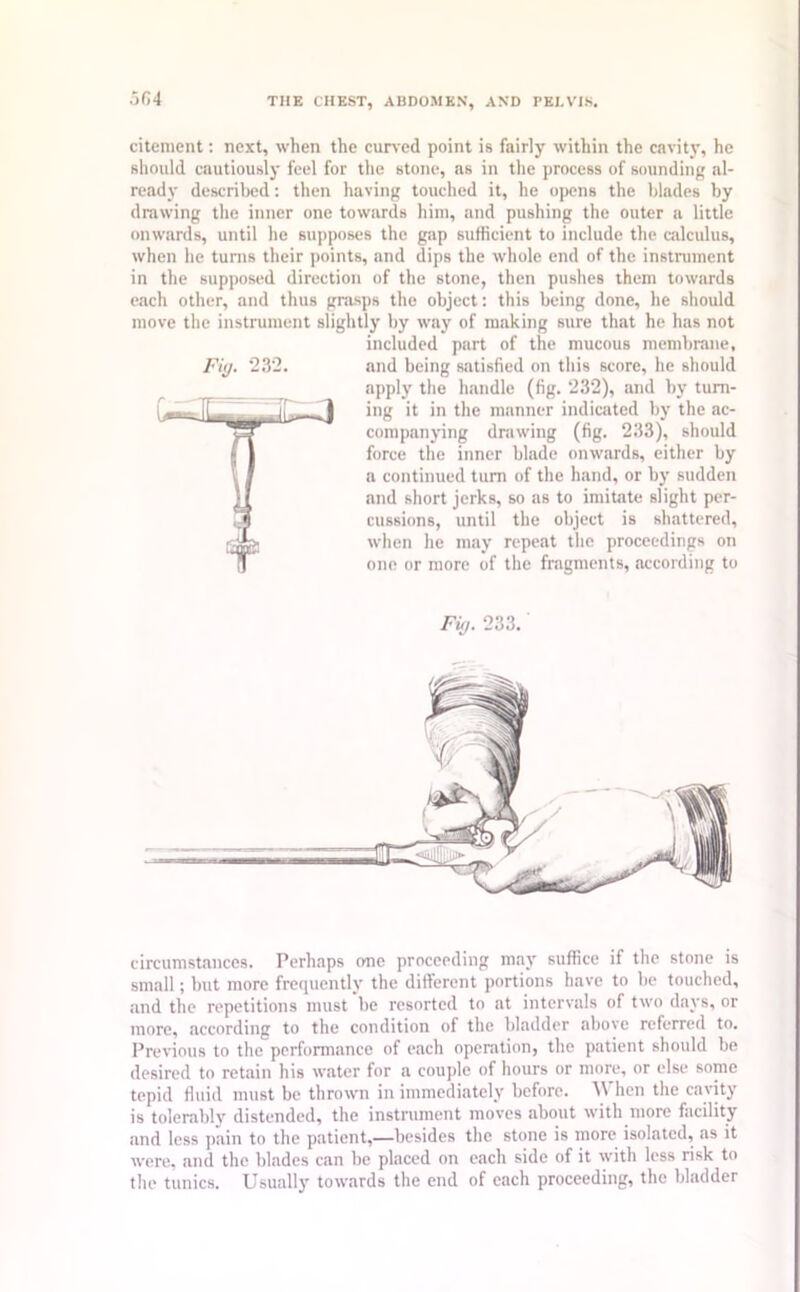 5r, 4 citement: next, when the curved point is fairly within the cavity, he should cautiously feel for the stone, as in the process of sounding al- ready described: then having touched it, he opens the blades by drawing the inner one towards him, and pushing the outer a little onwards, until he supposes the gap sufficient to include the calculus, when he turns their points, and dips the whole end of the instrument in the supposed direction of the stone, then pushes them towards each other, and thus grasps the object: this being done, he should move the instrument slightly by way of making sure that he has not included part of the mucous membrane, Fig. 232. and being satisfied on this score, he should apply the handle (fig. 232), and by turn- ing it in the manner indicated by the ac- companying drawing (fig. 233), should force the inner blade onwards, either by a continued turn of the hand, or by sudden and short jerks, so as to imitate slight per- cussions, until the object is shattered, when he may repeat the proceedings on one or more of the fragments, according to Fig. 233. circumstances. Perhaps one proceeding may suffice if the stone is small; but more frequently the different portions have to be touched, and the repetitions must be resorted to at intervals of two days, or more, according to the condition of the bladder above referred to. Previous to the performance of each operation, the patient should be desired to retain his water for a couple of hours or more, or else some tepid fluid must be thrown in immediately before. When the cavity is tolerably distended, the instrument moves about with more facility and less pain to the patient,—besides the stone is more isolated, as it were, and the blades can be placed on each side of it with less risk to the tunics. Usually towards the end of each proceeding, the bladder