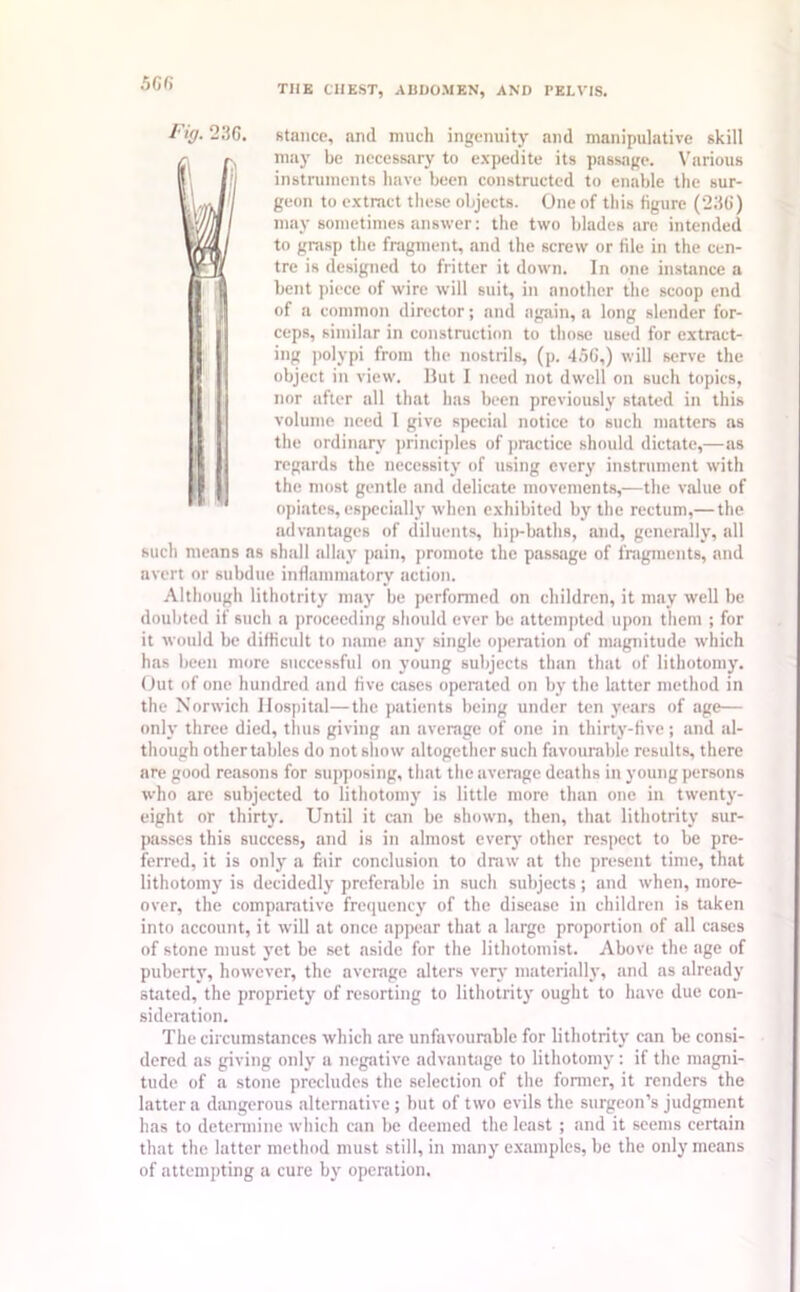 5GG TIIK CHEST, ABDOMEN, AND TELVIS. Fiff. 23G. stance, and much ingenuity and manipulative skill may be necessary to expedite its passage. Various instruments have been constructed to enable the sur- geon to extract these objects. One of this figure (23G) may sometimes answer: the two blades are intended to grasp the fragment, and the screw or file in the cen- tre is designed to fritter it down. In one instance a bent piece of wire will suit, in another the scoop end of a common director; and again, a long slender for- ceps, similar in construction to those used for extract- ing polypi from the nostrils, (p. 456,) will serve the object in view. Hut I need not dwell on such topics, nor after all that has been previously stated in this volume need 1 give special notice to such matters as the ordinary principles of practice should dictate,—as regards the necessity of using every instrument with the most gentle and delicate movements,—the value of opiates, especially when exhibited by the rectum,— the advantages of diluents, hip-baths, and, generally, all such means as shall allay pain, promote the passage of fragments, and avert or subdue inflammatory action. Although lithotrity may be performed on children, it may well be doubted if such a proceeding should ever be attempted upon them ; for it would be difficult to name .any single operation of magnitude which has been more successful on young subjects than that of lithotomy. Out of one hundred and five cases operated on by the latter method in the Norwich Hospital—the patients being under ten years of age— only three died, thus giving an average of one in thirty-five; and al- though othertables do not show altogether such favourable results, there are good reasons for supposing, that the average deaths in young persons who are subjected to lithotomy is little more than one in twenty- eight or thirty. Until it can be shown, then, that lithotrity sur- passes this success, and is in almost every other respect to be pre- ferred, it is only a fair conclusion to draw at the present time, that lithotomy is decidedly preferable in such subjects; and when, more- over, the comparative frequency of the disease in children is taken into account, it will at once appear that a large proportion of all cases of stone must yet be set aside for the lithotomist. Above the age of puberty, however, the average alters very materially, and as already stated, the propriety of resorting to lithotrity ought to have due con- sideration. The circumstances which are unfavourable for lithotrity can be consi- dered as giving only a negative advantage to lithotomy : if the magni- tude of a stone precludes the selection of the former, it renders the latter a dangerous alternative; but of two evils the surgeon’s judgment has to determine which can be deemed the least ; and it seems certain that the latter method must still, in many examples, be the only means of attempting a cure by operation.