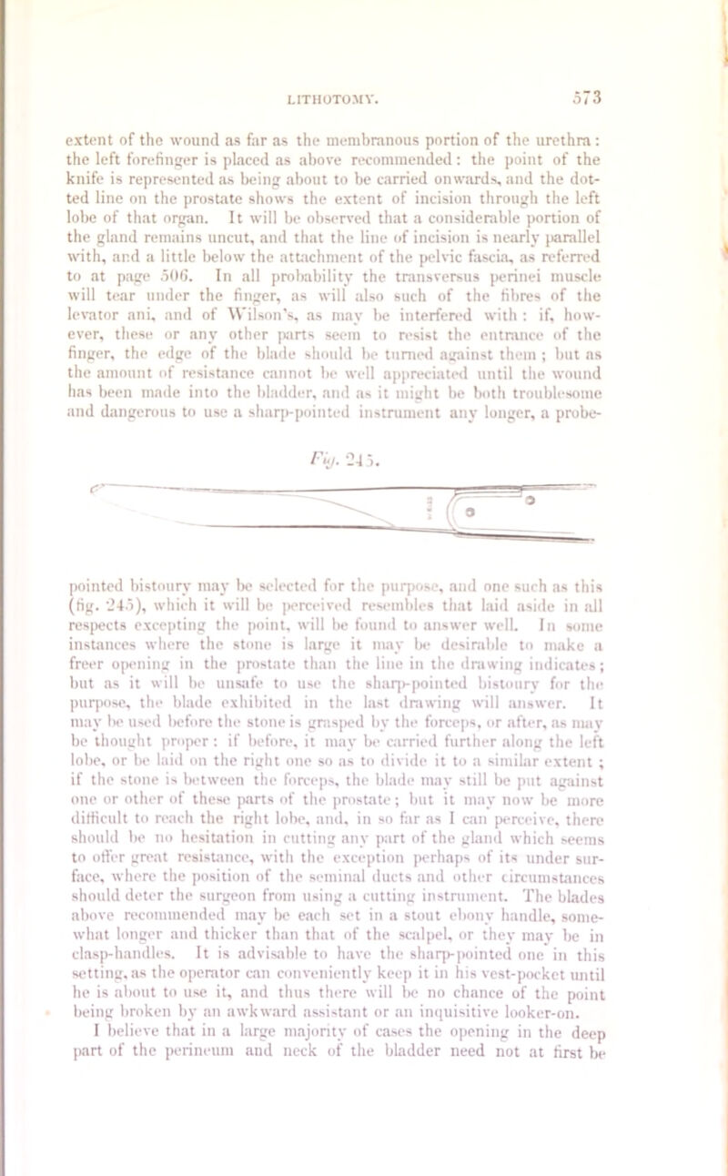 extent of the wound as far as the membranous portion of the urethra : the left forefinger is placed as above recommended: the point of the knife is represented as being about to be carried onwards, and the dot- ted line on the prostate shows the extent of incision through the left lobe of that organ. It will be observed that a considerable portion of the gland remains uncut, and that the line of incision is nearly jiarallel with, and a little below the attachment of the pelvic fascia, as referred to at page 506. In all probability the transversus perinei muscle will tear under the finger, as will also such of the fibres of the levator ani, and of Wilson’s, as may be interfered with : if, how- ever, these or any other parts seem to resist the entrance of the finger, the edge of the blade should be turned against them ; but as the amount of resistance cannot be well appreciated until the wound has been made into the bladder, and as it might be both troublesome and dangerous to use a sharp-pointed instrument any longer, a probe- pointed bistoury may be selected for the purpose, and one such as this (fig. '245), which it will be perceived resembles that laid aside in all respects excepting the point, will be found to answer well. In some instances where the stone is large it may be desirable to make a freer opening in the prostate than the line in the drawing indicates; but as it will be unsafe to use the sharp-pointed bistoury for the purpose, the blade exhibited in the last drawing will answer. It may be used before the stone is grasped by the forceps, or after, as may be thought proper : if before, it may be carried further along the left lobe, or be laid on the right one so as to divide it to a similar extent ; if the stone is between the forceps, the blade may still be put against one or other of these parts of the prostate; but it may now be more difficult to reach the right lobe, and, in so far as I can perceive, there should be no hesitation in cutting any part of the gland which seems to offer great resistance, with the exception perhaps of its under sur- face, where the position of the seminal ducts and other circumstances should deter the surgeon from using a cutting instrument. The blades above recommended may be each set in a stout ebony handle, some- what longer and thicker than that of the scalpel, or they may be in clasp-handles. It is advisable to have the sharp-pointed one in this setting, as the operator can conveniently keep it in his vest-pocket until he is about to use it, and thus there will be no chance of the point being broken by an awkward assistant or an inquisitive looker-on. I believe that in a large majority of cases the opening in the deep part of the perineum and neck of the bladder need not at first be