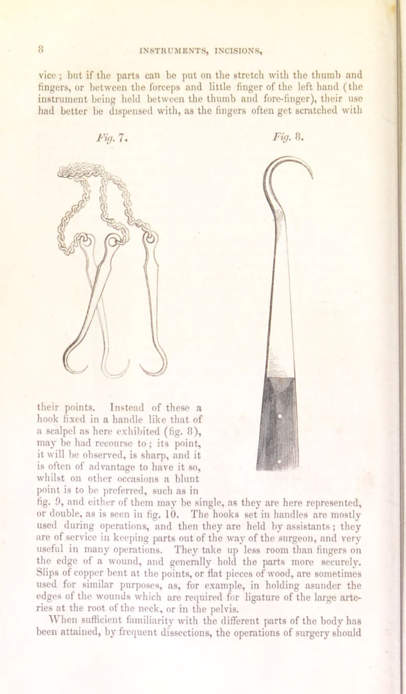 » vice ; but if the parts can be put on the stretch with tlie tliumb and fingers, or between the forceps and little finger of the left hand (the instrument being held between the thumb and fore-finger), their use had better be dispensed with, as the fingers often get scnitched with theii hook a SCI may it wi is of whilst on other occasions a blunt point is to be preferred, such as in fig. 9, and either of them may be single, as they are here represented, used during operations, and then they are held by assistants; they are of service in keeping parts out of the way of the surgeon, and very useful in many operations. They take up less room than fingers on the edge of a wound, and generally hold the parts more securely. Slips of copper bent at the points, or flat pieces of wood, are sometimes used for similar purposes, as, for example, in holding asunder the edges of the wounds which are required for ligature of the large arte- ries at the root of the neck, or in the pelvis. When sufficient familiarity with the different parts of the body has been attained, by frequent dissections, the operations of surgery should Ft!7.8.