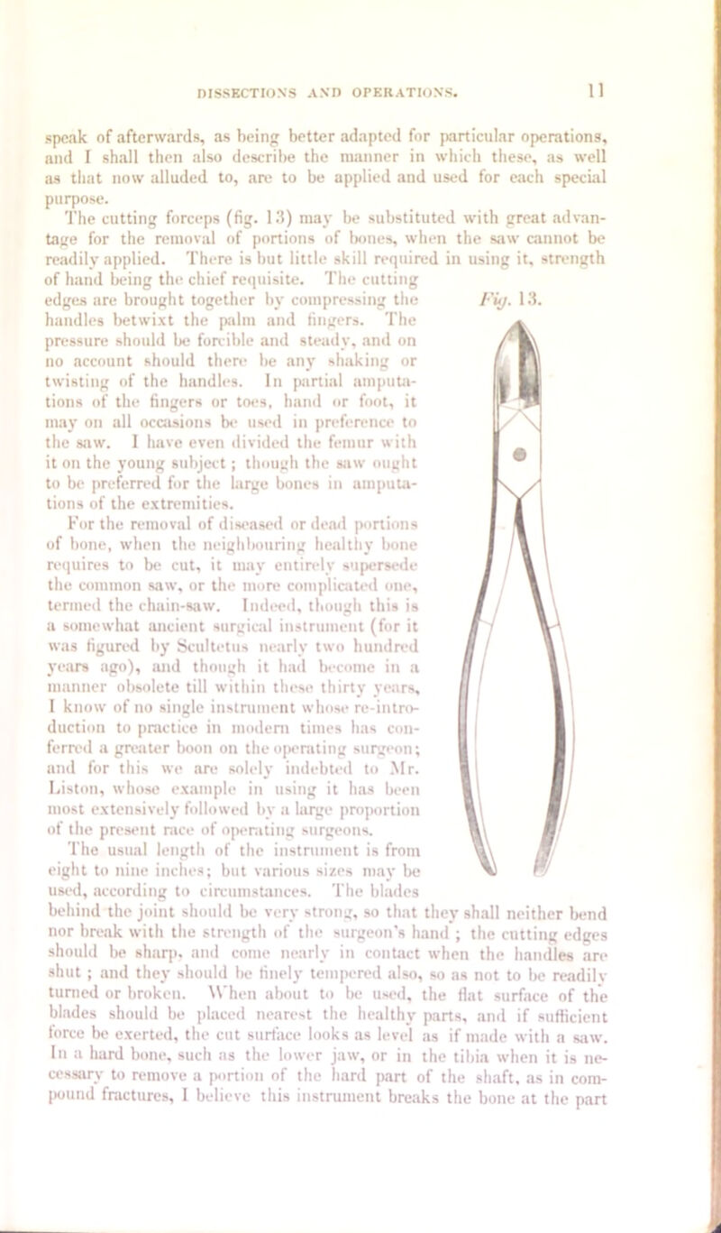 speak of afterwards, as being better adapted for particular operations, and I shall then also describe the manner in which these, as well as that now alluded to, are to be applied and used for each special purpose. The cutting forceps (fig. 1.3) may be substituted with great advan- tage for the removal of portions of iKines, when the saw cannot be readily applied. There is but little skill required in using it, strength of hand being the chief requisite. The cutting edges are brought together by compressing the Fiij. 13. handles lietwi.xt the palm and fingers. The pressure should be forcible and steady, and on no account should there be any shaking or twisting of the handles. In partial amputa- tions of the fingers or toes, hand or foot, it may on all occasions Ik- used in preference to the saw. 1 have even divided the femur with it on the young subject; though the saw ought to be preferred for the large bones in amputa- tions of the e.xtremities. For the removal of diseased or dead portions of bone, when the neighbouring healthy bone reiiuires to be cut, it may entirely supersede the common saw, or the more complicated one, termed the chain-saw. Indeed, though this is a somewhat ancient surgical instrument (for it was figured by Scult»'tus nearly two hundred years ago), mid though it had become in a manner obsolete till within these thirty years, 1 know of no single instrument whose re-intro- duction to practice in modem times has con- ferred a gri'ater boon on the operating surgeon; and for this we are solely indebted to .Mr. Liston, whose e.xample in using it has been most e.xtensively followed by a large pro])ortion of the present race of operating surgeons. The usual length of the instrument is from eight to nine inches; but various sizes may be usi‘d, according to circumstances. The blades behind the joint should be very strong, so that they shall neither bend nor break with the striuigth of the surgeon's hand ; the cutting edges should be shaqi, and come nearly in contact when the handles are shut ; and they should lie finelj’ tempered also, so as not to lie readilv turned or broken. When about to be used, the flat surface of the blades should be placed nearest the healthy parts, and if sufficient torce be exerted, the cut surtace looks as level ns if made with a siiw. In a hard bone, such ns the lower jaw, or in the tibia when it is ne- cessary to remove a portion of the liard part of the shaft, as in com- |xiund fractures, I believe this instrument bre.aks the bone at the part