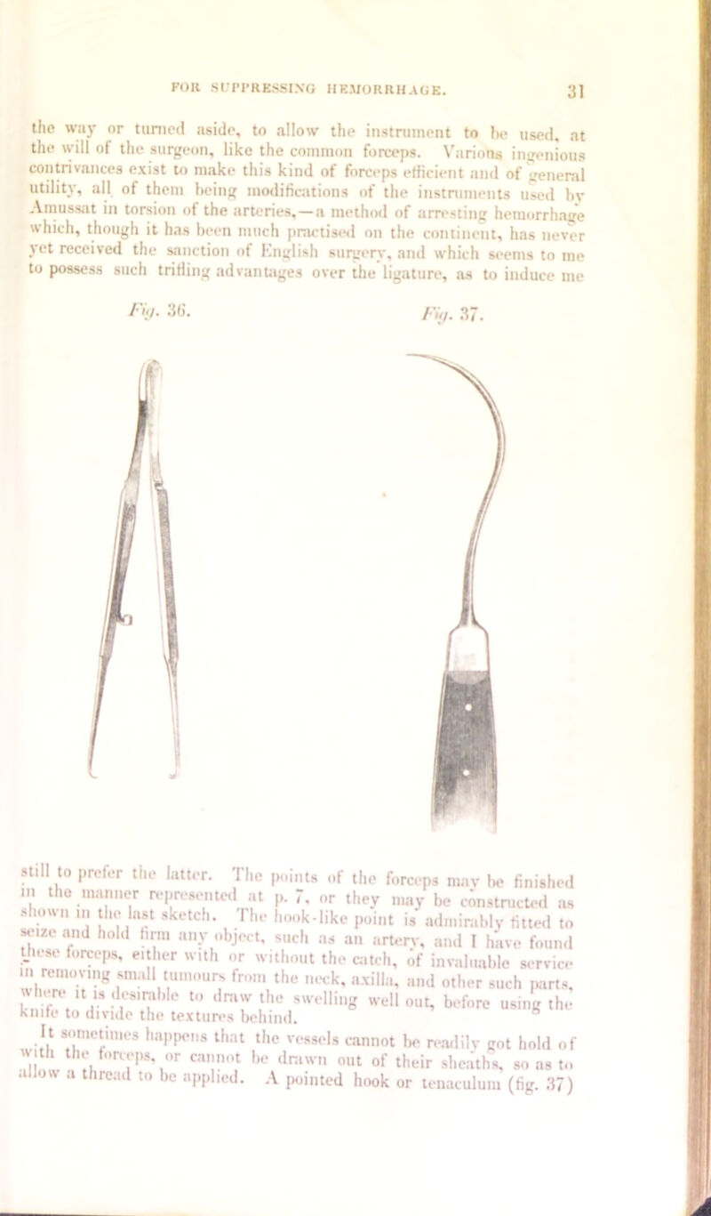 the way or turned aside, to allow the instrument to he used, at the will of the surgeon, like the common forceps. Varions ingenious contrivances exist to make this kind of forceps efficient and of general utility, all of them being modilfcations of the instniinents used hv Amussat in torsion of the arteries,—a methml of arresting hemorrhage which, though it has been much practised on the continent, has never yet received the sanction of Knglish surgery, and which seems to me to possess such trifling advantages over the ligature, as to induce me f’V- 3(1. /•«/. 37. still to prefer the latter. The points of the forceps may be finished in the manner n-presentcl at p. 7. or they may be constructed as shoun in tin* last sketch. The hook-like point is admirably fitted to «‘ize and hold hrm any object, such as an artery, and I have found Uiese forceps, either with or without the catch, of invaluable sc-rvice in removing small tumours from the lu-ck, axilla, and other such iwrt.s, LM.'ir.'V- r'T before using the Kiiik* to divide the textun*s beliind. ^ It sometimes happens that the vessels cannot be re.adily got hold of « th the forceps, or cannot be dn.wii out of their sheaths, so as to allow a thread to be applied. A pointed hook or tenaculum (fig. .37)