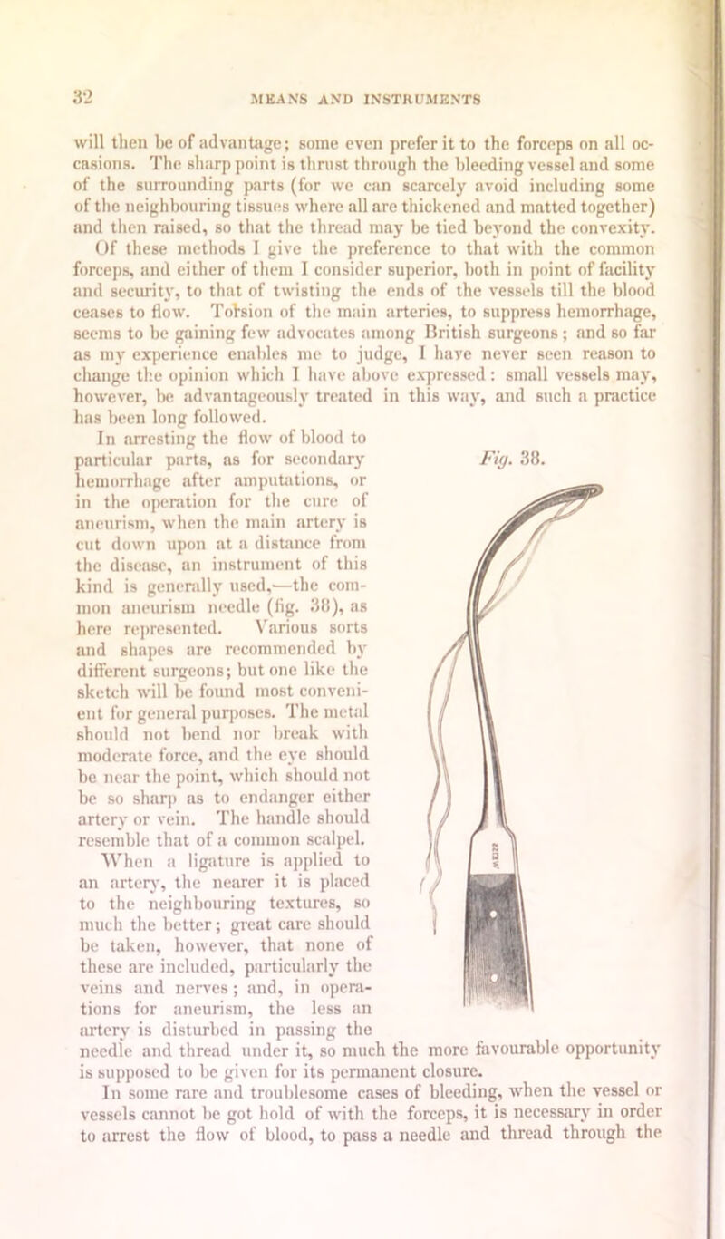 will then be of advantage; some even prefer it to the forceps on all oc- casions. The sharp point is thrust through the bleeding vessel and some of the surrounding parts (for we can scarcely avoid including some of tlie neighbouring tissues where all are thickened and matted together) and then raised, so that the thread may be tied beyond the convexity. Of these methods I give the preference to that with the common forceps, and cither of them I consider superior, both in point of facility and secimitj', to that of twisting the ends of the vessels till the blood ceases to flow. Tohsion of the main arteries, to suppress hemorrhage, seems to be gaining few advocates among British surgeons ; and so far as my experience enables me to judge, I have never seen reason to change the opinion which I have above e.xpressed: small vessels may, however, be advantageously treated in this way, and such a practice has been long followed. In arresting the flow of blood to hemorrhage after amputations, or in the operation for the cure of aneurism, when the main artery is cut down upon at a distance from the disease, an instrument of this kind is generally used,—the com- mon aneurism needle (fig. 38), as here re])resented. \'arious sorts and shapes are recommended bj' different surgeons; but one like the sketch will be found most conveni- ent for general puqioses. The metal should not bend nor break with moderate force, and the eye should be near the point, which should not be so sharp as to endanger either artery or vein. The handle should resemble that of a common scalpel. When a lig-aturc is applied to an arterv', the nearer it is placed to the neighbouring textures, so much the better ; great care should be taken, however, that none of these are included, particularly the veins and nerves; and, in opera- tions for aneurism, the less an artery is disturbed in passing the needle and thread under it, so much the more favourable opportunity is supposed to be given for its pennanent closure. In some rare and troublesome cases of bleeding, when the vessel or vessels cannot be got hold of with the forceps, it is necessary in order to arrest the flow of blood, to pass a needle and thread through the