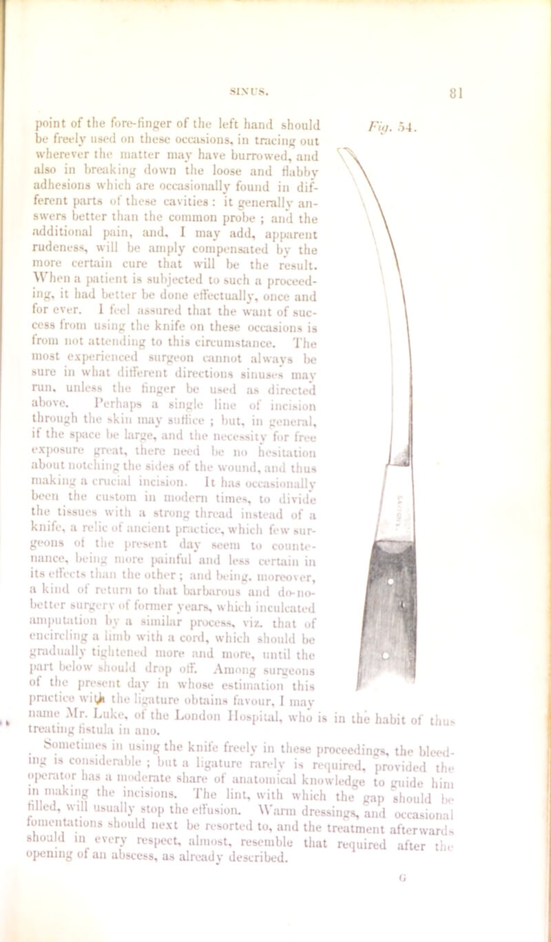 Fill. .54. point of the fore-tinger of the left hand should be freely used on these occasions, in tracing out wherever the matter may have burrowed, and also in breaking down the loose and tlabbv adhesions which are occasionally found in dif- ferent parts of these caviiies : it generally an- swers better than the common probe ; anil the additional pain, and. I may add, apparent rudeness, will be amply compensated by the more certain cure that will be the result. When a jKUient is subjected to such a proceed- ing, it had better be done effectually, once and for ever. 1 feel assured that the want of suc- cess from using the knife on these occasions is from not atumding to this circumstance. The most experienced surgeon cannot always lie sure in what different directions sinuses mav run. unless the linger be used as directed above. Perhaps a single line of incision through the skin may suffice ; but, in general, if the space be large, and the necessity for free exposure gU'at, there need be no hesiiation about notching the sides of the wound, and thus making a crucial incision. It h:is occasionally been the custom in modeni times, to divide the tissues with a strong thread instead of a knife, a relic of ancient pnictice, which few sur- geons ol the present day seem to counU-- nance, being more painful and less ceruiin in its effects than the other; and iK-ing. moreover, a kind ot return to that barbarous and do-ni>- better surgery of fonner years, which inculcated imipuUttion by a similar proces.s, viz. that of encircling a limb with a coiil, which shoidd be gradually tightened more and more, until the jiart below should drop off. Among surgeons of the present day in whose estimation this practice wii^ the li;^ture obtains favour, I m.iy iiiune .Mr. Luke, of the London Hospital, who is in the habit of thus treating fistula in ano. Sometimes in using the knife freely in these proceedings, the bleed- ing IS considerable ; but a ligature rarely is required, provided the operator has a moderate share of anatomical knowledge to guide him m making the incisions. The lint, with which the gap should be hlled, w ill usuiilly stop the effusion. Warm dressings, and occasional lomentatioiis should next be resorted to, and the treatment afterwards should in every respect, almost, resemble that required after the opening of an abscess, as already described.