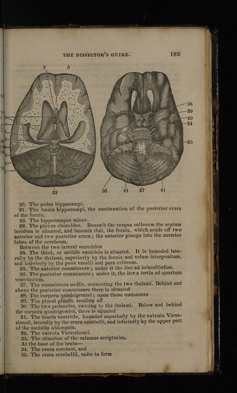  21. The toenia hippocampi, the continuation of the posterior crura of the fornix. 22, The hippocampus minor. 23. The plexus choroides. Beneath the corpus callosum the septum lucidum is situated, and beneath that, the fornix, which sends off two anterior and two posterior crura; the anterior plunge into the anterior lobes of the cerebrum. Between the two lateral ventricles 24. The third, or middle ventricle is situated. It is bounded late- rally by the thalami, superiorly by the fornix and velum interpositum, and inferiorly by the pons varolii and pars cribrosa. 25. The anterior commissure ; under it the iter ad infundibulum. 26. The posterior commissure ; under it, the itera tertia ad. quartum ventricujum., 27, The commissura mollis, connecting the two thalami. Behind and above the posterior commissure there is situated 98. The corpora quadrigemini; upon these eminences 29. The pineal glands, sending off 30. The two peduncles, running to the thalami. Below and behind the corpora quadrigemini, there is situated 31. The fourth ventricle, bounded superiorly by the valvula Vieus- siensii, laterally by the crura cerebelli, and inferiorly by the upper part of the medulla oblongata. 32. The valvula Vieussiensil. 33. The situation of the calamus scriptorius. At the base of the brain— 34. The crura cereberi, and 35.. The crura cerebellii, unite to form wea ams WE GNU OL aca ORE Perle 