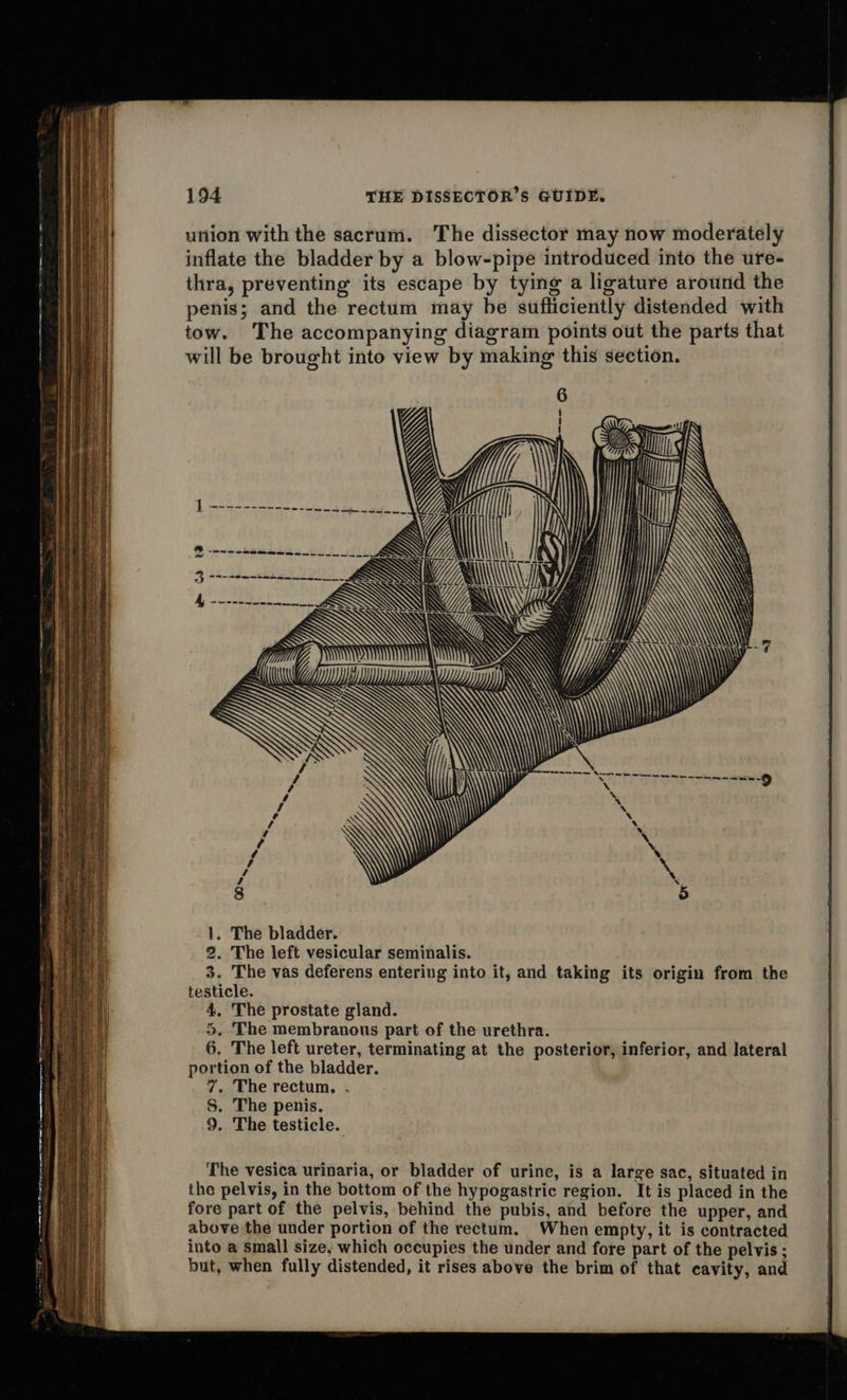   194 THE DISSECTOR’S GUIDE. union with the sacrum. The dissector may now moderately inflate the bladder by a blow-pipe introduced into the ure- thra, preventing its escape by tying a ligature around the penis; and the rectum may be sufliciently distended with tow. The accompanying diagram points out the parts that will be brought into view by making this section. Yo Up yf y I MW | / 4 ¢ , / / 8 1. The bladder. 2. The left vesicular seminalis. 3. The vas deferens entering into it, and taking its origin from the testicle. 4. The prostate gland. 5. The membranous part of the urethra. 6. The left ureter, terminating at the posterior, inferior, and lateral portion of the bladder. 8S. The penis. 9. The testicle. The vesica urinaria, or bladder of urine, is a large sac, situated in the pelvis, in the bottom of the hypogastric region. It is placed in the fore part of the pelvis, behind the pubis, and before the upper, and above the under portion of the rectum. When empty, it is contracted into a small size, which occupies the under and fore part of the pelvis ; but, when fully distended, it rises above the brim of that cavity, and 