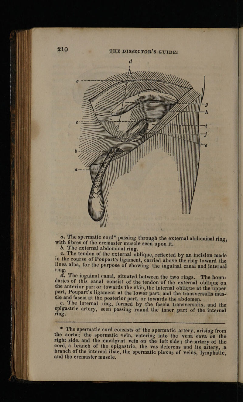  d ome ee tziz;¢z ZZ. a. The spermatic cord* passing through the external abdominal ring, with fibres of the cremaster muscle seen upon it. b. The external abdominal ring. c. The tendon of the external oblique, reflected by an incision made in the course of Poupart’s ligament, carried above the ring toward the linea alba, for the purpose of showing the inguinal canal and internal ring. d. The inguinal canal, situated between the two rings. The boun- daries of this canal consist of the tendon of the external oblique on the anterior part or towards the skin, the internal oblique at the upper part, Poupart’s ligament at the lower part, and the transversalis mus- cle and fascia at the posterior part, or towards the abdomen. e. The internal ring, formed by the fascia transversalis, and the epigastric artery, seen passing round the inner part of the internal ring. 22S SE otis) ae * The spermatic cord consists of the spermatic artery, arising from the aorta; the spermatic vein, entering into the vena cava on the right side, and the emulgent vein on the left side; the artery of the cord, a branch of the epigastric, the vas deferens and its artery, a branch of the internal iliac, the spermatic plexus of veins, lymphatic, and the cremaster muscle. 