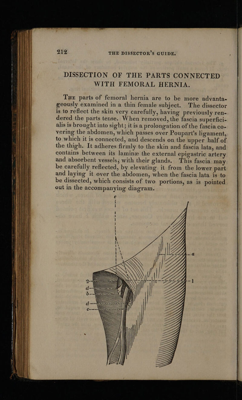 DISSECTION OF THE PARTS CONNECTED WITH FEMORAL HERNIA. Tue parts of femoral hernia are to be more advanta- geously examined in a thin female subject. The dissector is to reflect the skin very carefully, having previously ren- dered the parts tense. When removed, the fascia superfici- alis is brought into sight; it is a prolongation of the fascia co- vering the abdomen, which passes over Poupart’s ligament, to which it is connected, and descends on the upper half of the thigh. It adheres firmly to the skin and fascia lata, and contains between its lamine the external epigastric artery and absorbent vessels; with their glands. This fascia may be carefully reflected, by elevating it from the lower part and laying it over the abdomen, when the fascia lata is to be dissected, which consists of two portions, as is pointed out in the accompanying diagram. ba) 