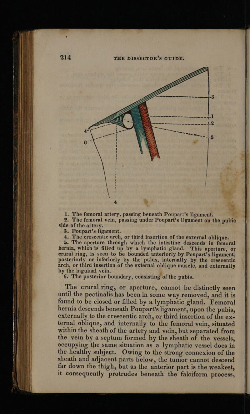 ny 2. The femoral vein, passing under Poupart’s ligament on the pubic side of the artery. 3. Poupart’s ligament. 4. The crescentic arch, or third insertion of the external oblique. 5. The aperture through which the intestine descends in femoral hernia, which is filled up by a lymphatic gland. This aperture, or crural ring, is seen to be bounded anteriorly by Poupart’s ligament, posteriorly or inferiorly by the pubis, internally by the crescentic arch, or third insertion of the external oblique muscle, and externally by the inguinal vein. 6. The posterior boundary, consisting of the pubis. The crural ring, or aperture, cannot be distinctly seen until the pectinalis has been in some way removed, and it is found to be closed or filled by a lymphatic gland. Femoral hernia descends beneath Poupart’s ligament, upon the pubis, externally to the crescentic arch, or third insertion of the ex- ternal oblique, and internally to the femoral vein, situated within the sheath of the artery and vein, but separated from the vein by a septum formed by the sheath of the vessels, occupying the same situation as a lymphatic vessel does in the healthy subject. Owing to the strong connexion of the sheath and adjacent parts below, the tumor cannot descend far down the thigh, but as the anterior part is the weakest, it consequently protrudes beneath the falciform process, 